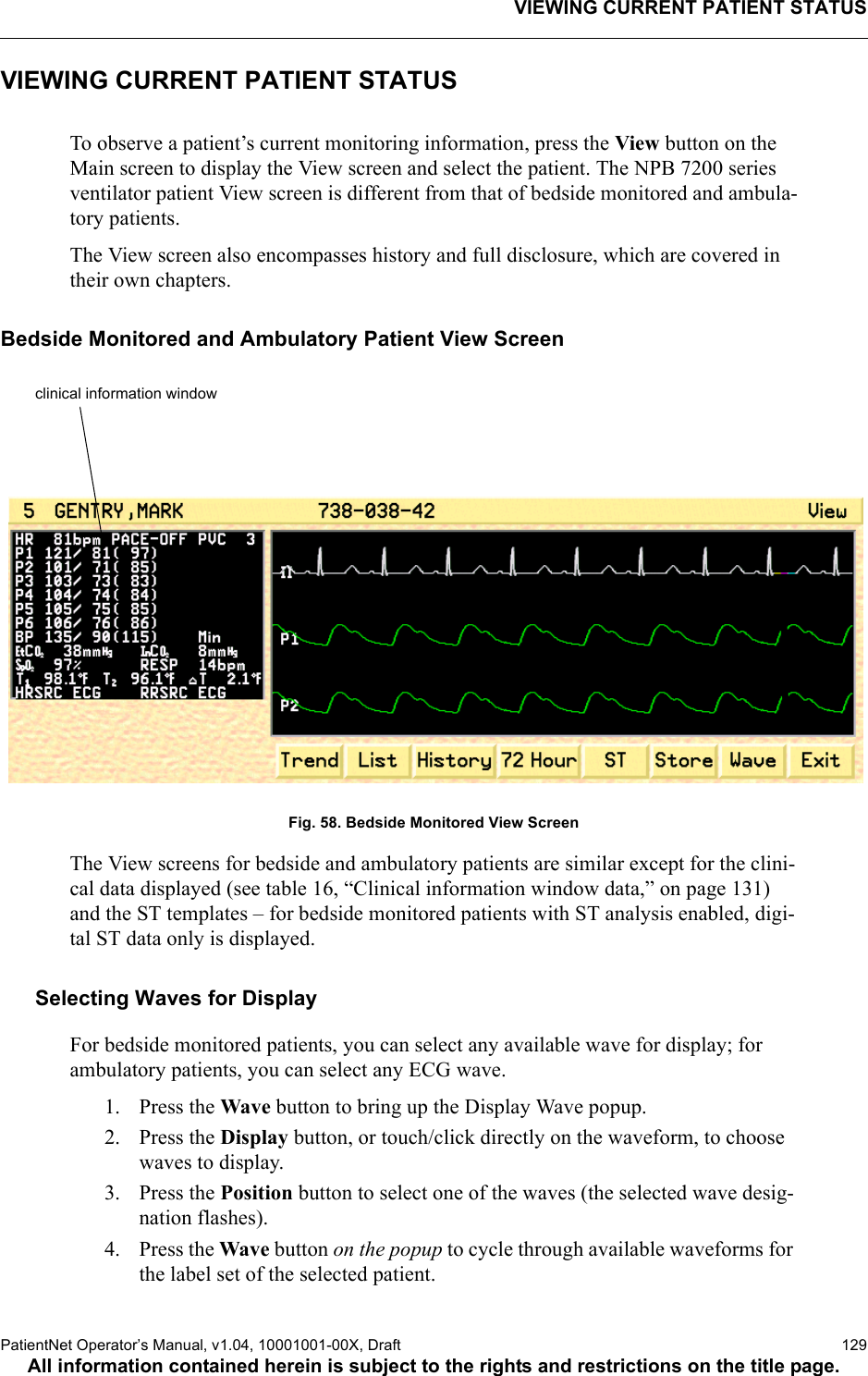 VIEWING CURRENT PATIENT STATUSPatientNet Operator’s Manual, v1.04, 10001001-00X, Draft   129All information contained herein is subject to the rights and restrictions on the title page.VIEWING CURRENT PATIENT STATUSTo observe a patient’s current monitoring information, press the View button on the Main screen to display the View screen and select the patient. The NPB 7200 series ventilator patient View screen is different from that of bedside monitored and ambula-tory patients.The View screen also encompasses history and full disclosure, which are covered in their own chapters.Bedside Monitored and Ambulatory Patient View ScreenFig. 58. Bedside Monitored View Screen The View screens for bedside and ambulatory patients are similar except for the clini-cal data displayed (see table 16, “Clinical information window data,” on page 131) and the ST templates – for bedside monitored patients with ST analysis enabled, digi-tal ST data only is displayed.Selecting Waves for DisplayFor bedside monitored patients, you can select any available wave for display; for ambulatory patients, you can select any ECG wave.1. Press the Wave button to bring up the Display Wave popup.2. Press the Display button, or touch/click directly on the waveform, to choose waves to display.3. Press the Position button to select one of the waves (the selected wave desig-nation flashes).4. Press the Wave button on the popup to cycle through available waveforms for the label set of the selected patient.clinical information window