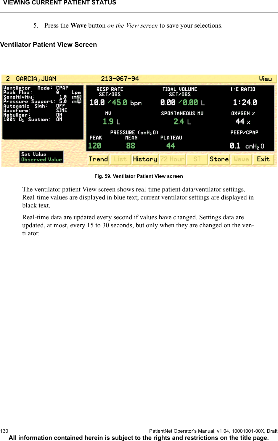 VIEWING CURRENT PATIENT STATUS130  PatientNet Operator’s Manual, v1.04, 10001001-00X, DraftAll information contained herein is subject to the rights and restrictions on the title page.5. Press the Wave button on the View screen to save your selections.Ventilator Patient View ScreenFig. 59. Ventilator Patient View screenThe ventilator patient View screen shows real-time patient data/ventilator settings. Real-time values are displayed in blue text; current ventilator settings are displayed in black text.Real-time data are updated every second if values have changed. Settings data are updated, at most, every 15 to 30 seconds, but only when they are changed on the ven-tilator.