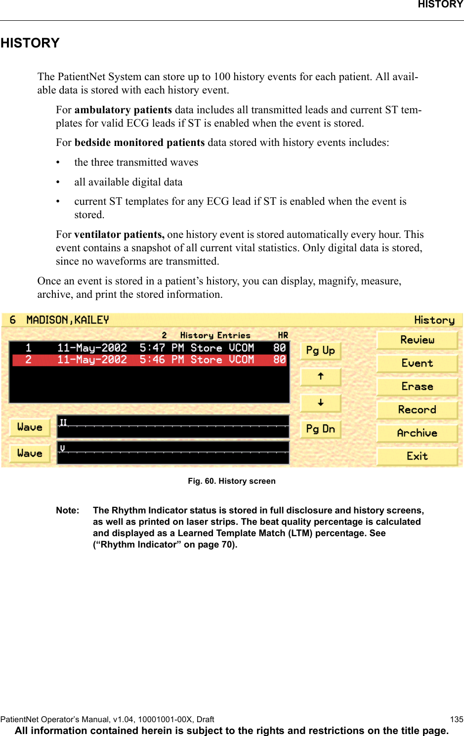 HISTORYPatientNet Operator’s Manual, v1.04, 10001001-00X, Draft   135All information contained herein is subject to the rights and restrictions on the title page.HISTORY The PatientNet System can store up to 100 history events for each patient. All avail-able data is stored with each history event.For ambulatory patients data includes all transmitted leads and current ST tem-plates for valid ECG leads if ST is enabled when the event is stored.For bedside monitored patients data stored with history events includes:• the three transmitted waves• all available digital data• current ST templates for any ECG lead if ST is enabled when the event is stored.For ventilator patients, one history event is stored automatically every hour. This event contains a snapshot of all current vital statistics. Only digital data is stored, since no waveforms are transmitted.Once an event is stored in a patient’s history, you can display, magnify, measure, archive, and print the stored information.Fig. 60. History screenNote: The Rhythm Indicator status is stored in full disclosure and history screens, as well as printed on laser strips. The beat quality percentage is calculated and displayed as a Learned Template Match (LTM) percentage. See (“Rhythm Indicator” on page 70).