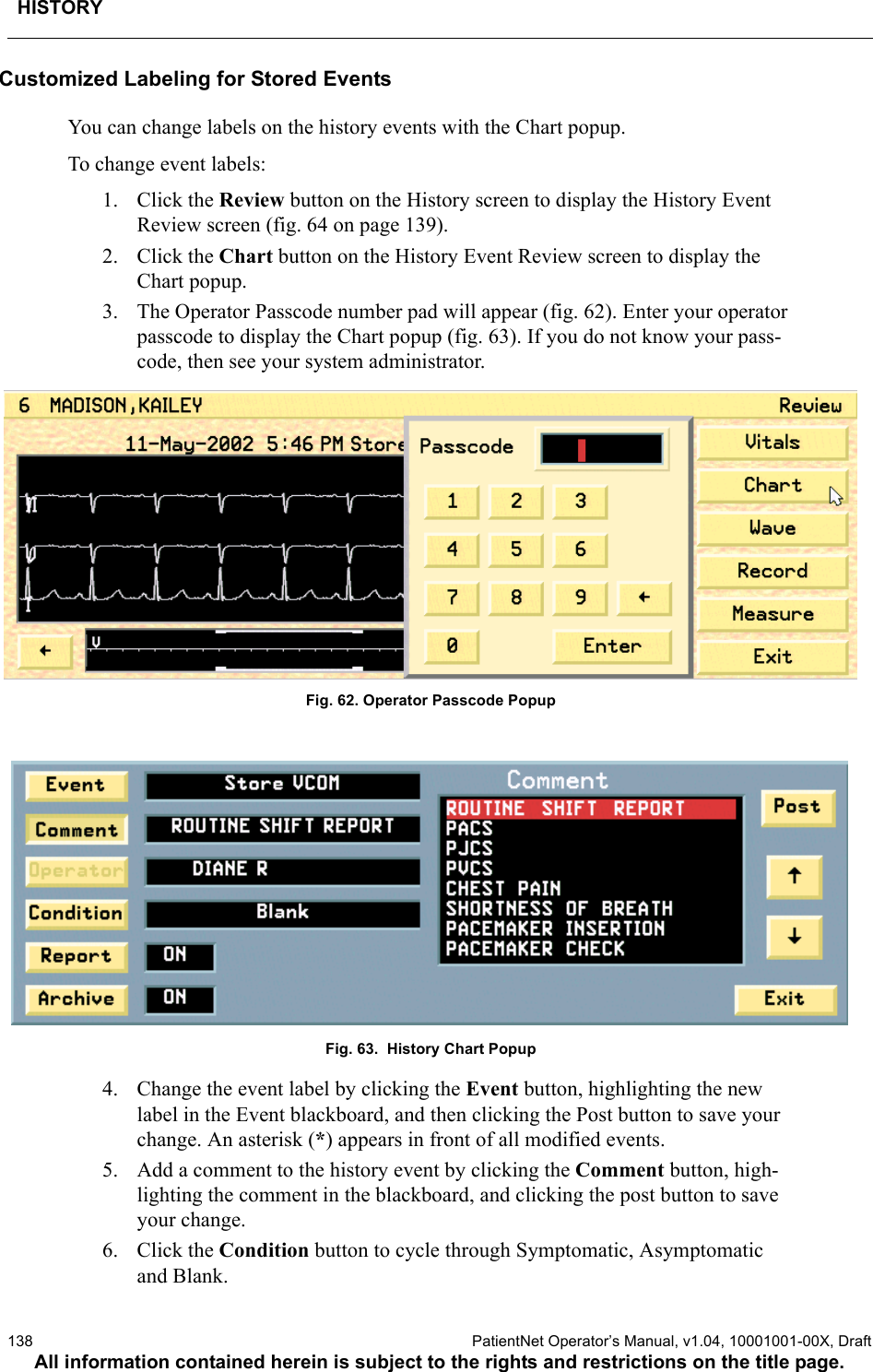 HISTORY138  PatientNet Operator’s Manual, v1.04, 10001001-00X, DraftAll information contained herein is subject to the rights and restrictions on the title page.Customized Labeling for Stored EventsYou can change labels on the history events with the Chart popup.To change event labels:1. Click the Review button on the History screen to display the History Event Review screen (fig. 64 on page 139).2. Click the Chart button on the History Event Review screen to display the Chart popup.3. The Operator Passcode number pad will appear (fig. 62). Enter your operator passcode to display the Chart popup (fig. 63). If you do not know your pass-code, then see your system administrator.Fig. 62. Operator Passcode PopupFig. 63.  History Chart Popup4. Change the event label by clicking the Event button, highlighting the new label in the Event blackboard, and then clicking the Post button to save your change. An asterisk (*) appears in front of all modified events.5. Add a comment to the history event by clicking the Comment button, high-lighting the comment in the blackboard, and clicking the post button to save your change.6. Click the Condition button to cycle through Symptomatic, Asymptomatic and Blank.