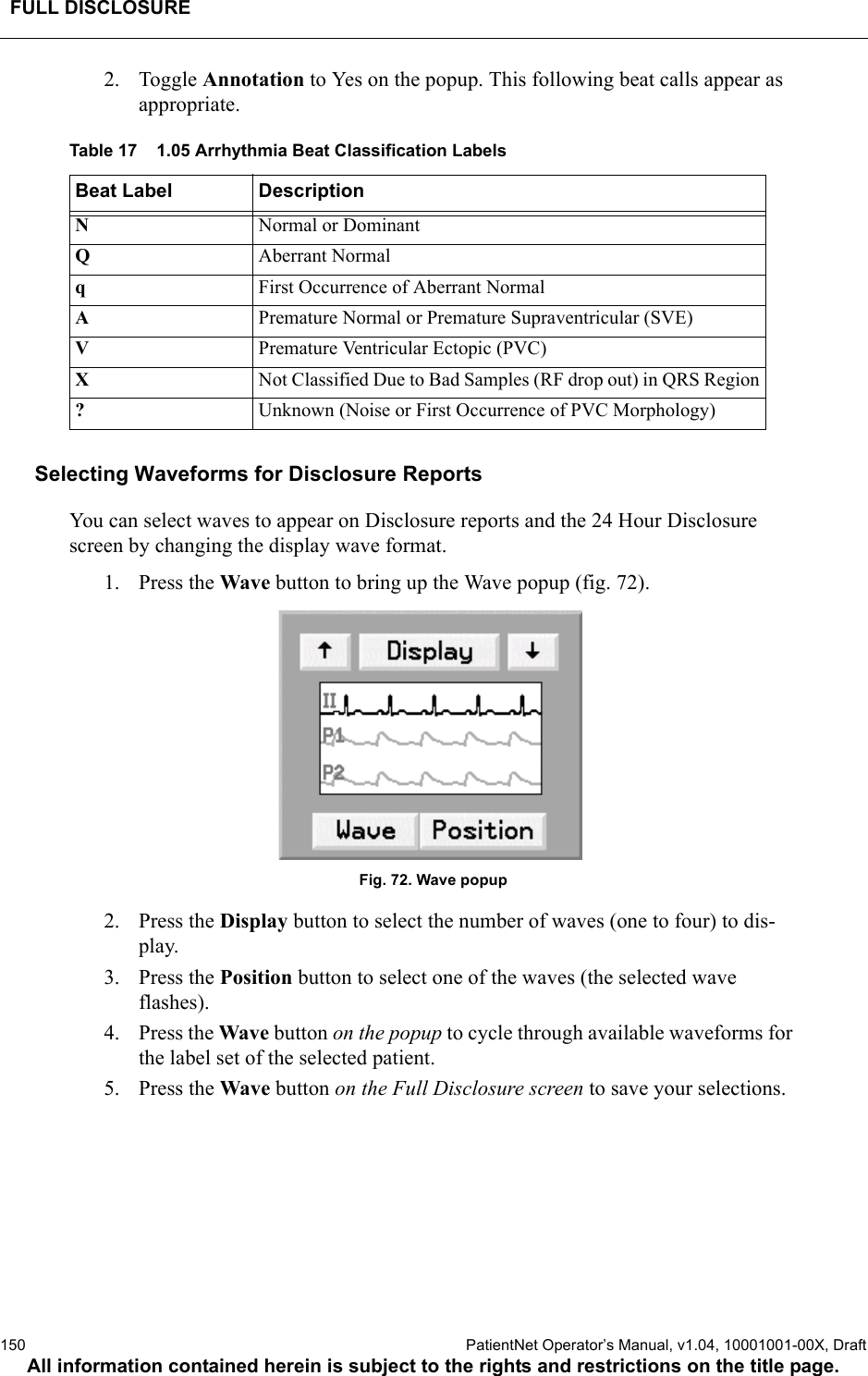 FULL DISCLOSURE150  PatientNet Operator’s Manual, v1.04, 10001001-00X, DraftAll information contained herein is subject to the rights and restrictions on the title page.2. Toggle Annotation to Yes on the popup. This following beat calls appear as appropriate.Table 17    1.05 Arrhythmia Beat Classification LabelsSelecting Waveforms for Disclosure ReportsYou can select waves to appear on Disclosure reports and the 24 Hour Disclosure screen by changing the display wave format. 1. Press the Wave button to bring up the Wave popup (fig. 72).Fig. 72. Wave popup2. Press the Display button to select the number of waves (one to four) to dis-play.3. Press the Position button to select one of the waves (the selected wave flashes).4. Press the Wave button on the popup to cycle through available waveforms for the label set of the selected patient.5. Press the Wave button on the Full Disclosure screen to save your selections.Beat Label DescriptionNNormal or DominantQAberrant NormalqFirst Occurrence of Aberrant NormalAPremature Normal or Premature Supraventricular (SVE)VPremature Ventricular Ectopic (PVC)XNot Classified Due to Bad Samples (RF drop out) in QRS Region?Unknown (Noise or First Occurrence of PVC Morphology)