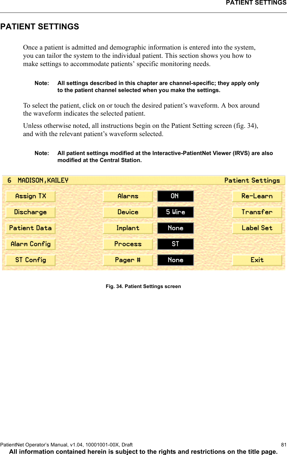 PATIENT SETTINGSPatientNet Operator’s Manual, v1.04, 10001001-00X, Draft   81All information contained herein is subject to the rights and restrictions on the title page.PATIENT SETTINGSOnce a patient is admitted and demographic information is entered into the system, you can tailor the system to the individual patient. This section shows you how to make settings to accommodate patients’ specific monitoring needs.Note: All settings described in this chapter are channel-specific; they apply only to the patient channel selected when you make the settings. To select the patient, click on or touch the desired patient’s waveform. A box around the waveform indicates the selected patient.Unless otherwise noted, all instructions begin on the Patient Setting screen (fig. 34), and with the relevant patient’s waveform selected.Note: All patient settings modified at the Interactive-PatientNet Viewer (IRVS) are also modified at the Central Station.Fig. 34. Patient Settings screen