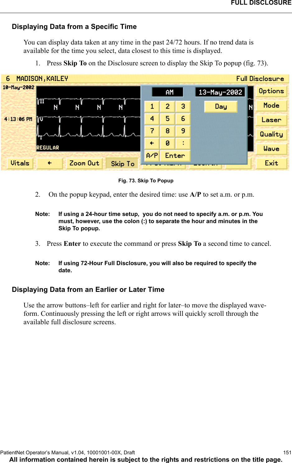 FULL DISCLOSUREPatientNet Operator’s Manual, v1.04, 10001001-00X, Draft    151All information contained herein is subject to the rights and restrictions on the title page.Displaying Data from a Specific TimeYou can display data taken at any time in the past 24/72 hours. If no trend data is available for the time you select, data closest to this time is displayed. 1. Press Skip To on the Disclosure screen to display the Skip To popup (fig. 73).Fig. 73. Skip To Popup2.  On the popup keypad, enter the desired time: use A/P to set a.m. or p.m. Note: If using a 24-hour time setup,  you do not need to specify a.m. or p.m. You must, however, use the colon (:) to separate the hour and minutes in the Skip To popup.3. Press Enter to execute the command or press Skip To a second time to cancel.Note: If using 72-Hour Full Disclosure, you will also be required to specify the date.Displaying Data from an Earlier or Later TimeUse the arrow buttons–left for earlier and right for later–to move the displayed wave-form. Continuously pressing the left or right arrows will quickly scroll through the available full disclosure screens.