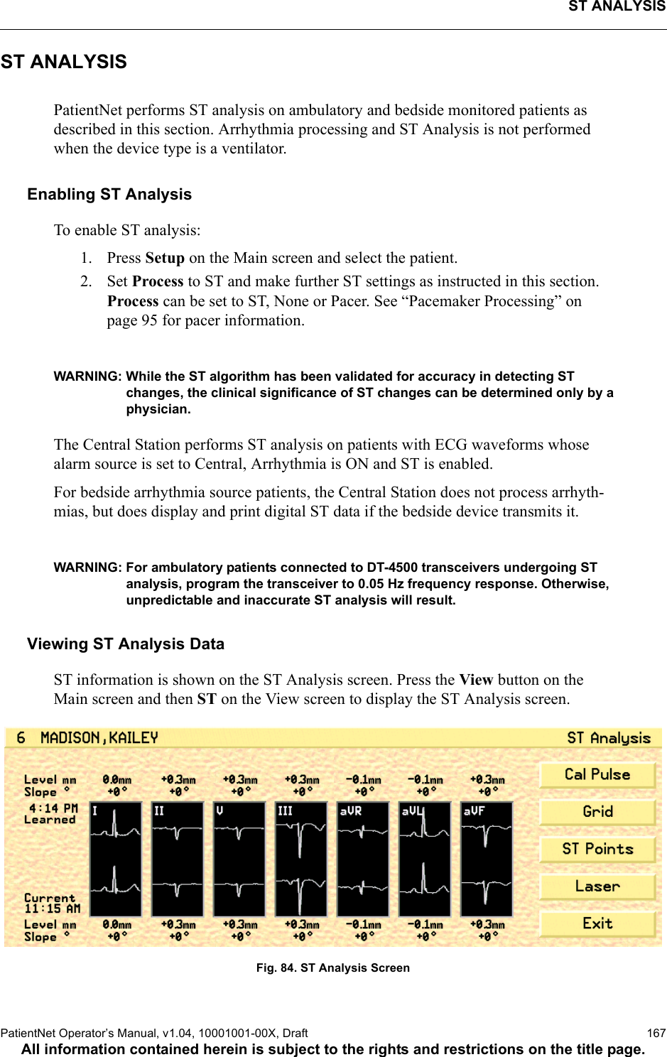 ST ANALYSISPatientNet Operator’s Manual, v1.04, 10001001-00X, Draft   167All information contained herein is subject to the rights and restrictions on the title page.ST ANALYSISPatientNet performs ST analysis on ambulatory and bedside monitored patients as described in this section. Arrhythmia processing and ST Analysis is not performed when the device type is a ventilator.Enabling ST AnalysisTo enable ST analysis:1. Press Setup on the Main screen and select the patient.2. Set Process to ST and make further ST settings as instructed in this section. Process can be set to ST, None or Pacer. See “Pacemaker Processing” on page 95 for pacer information.WARNING: While the ST algorithm has been validated for accuracy in detecting ST changes, the clinical significance of ST changes can be determined only by a physician.The Central Station performs ST analysis on patients with ECG waveforms whose alarm source is set to Central, Arrhythmia is ON and ST is enabled. For bedside arrhythmia source patients, the Central Station does not process arrhyth-mias, but does display and print digital ST data if the bedside device transmits it.WARNING: For ambulatory patients connected to DT-4500 transceivers undergoing ST analysis, program the transceiver to 0.05 Hz frequency response. Otherwise, unpredictable and inaccurate ST analysis will result.Viewing ST Analysis DataST information is shown on the ST Analysis screen. Press the View button on the Main screen and then ST on the View screen to display the ST Analysis screen.Fig. 84. ST Analysis Screen