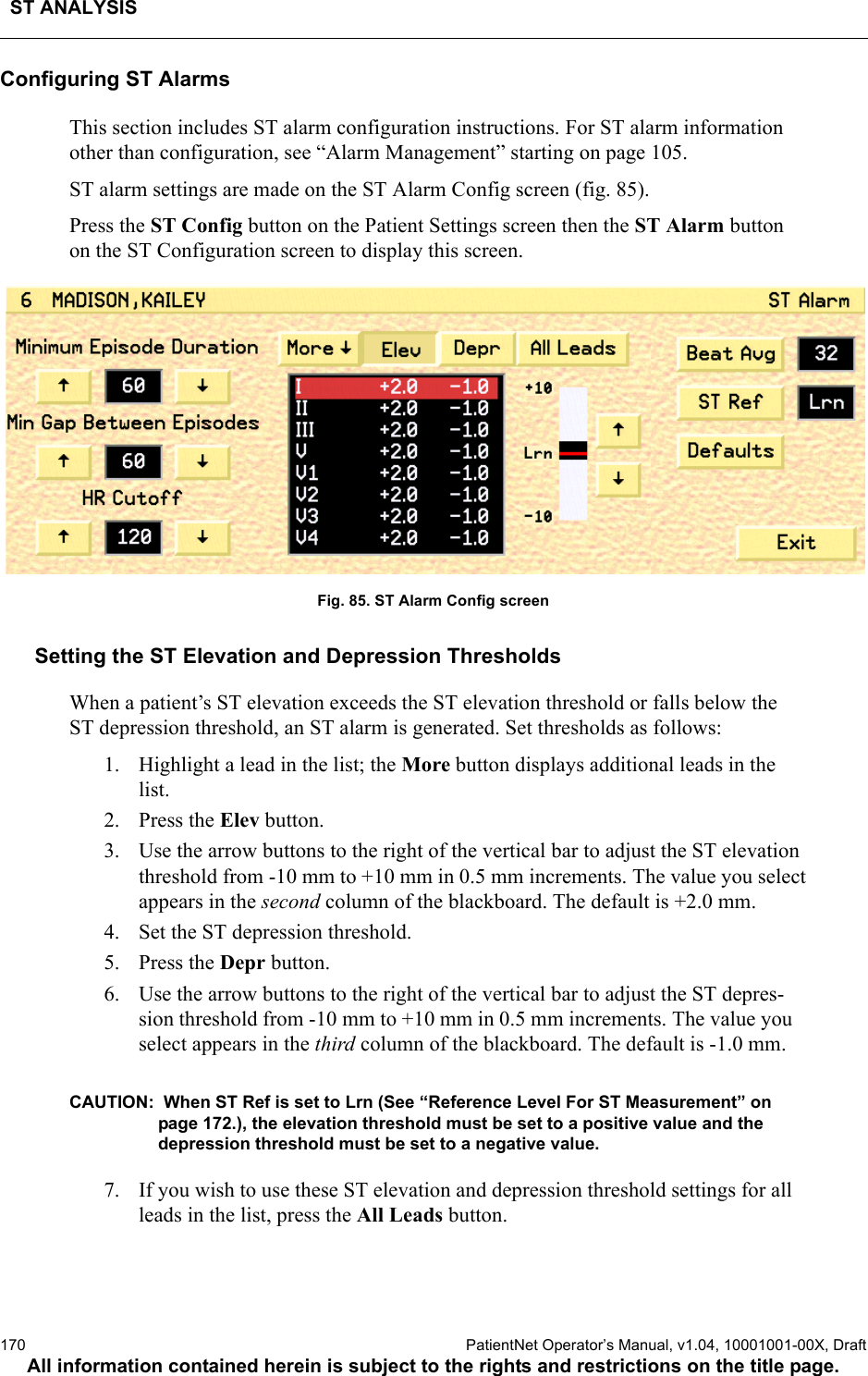 ST ANALYSIS170  PatientNet Operator’s Manual, v1.04, 10001001-00X, DraftAll information contained herein is subject to the rights and restrictions on the title page.Configuring ST Alarms This section includes ST alarm configuration instructions. For ST alarm information other than configuration, see “Alarm Management” starting on page 105.ST alarm settings are made on the ST Alarm Config screen (fig. 85). Press the ST Config button on the Patient Settings screen then the ST Alarm button on the ST Configuration screen to display this screen.Fig. 85. ST Alarm Config screenSetting the ST Elevation and Depression ThresholdsWhen a patient’s ST elevation exceeds the ST elevation threshold or falls below the ST depression threshold, an ST alarm is generated. Set thresholds as follows:1. Highlight a lead in the list; the More button displays additional leads in the list. 2. Press the Elev button. 3. Use the arrow buttons to the right of the vertical bar to adjust the ST elevation threshold from -10 mm to +10 mm in 0.5 mm increments. The value you select appears in the second column of the blackboard. The default is +2.0 mm.4. Set the ST depression threshold.5. Press the Depr button. 6. Use the arrow buttons to the right of the vertical bar to adjust the ST depres-sion threshold from -10 mm to +10 mm in 0.5 mm increments. The value you select appears in the third column of the blackboard. The default is -1.0 mm.CAUTION:  When ST Ref is set to Lrn (See “Reference Level For ST Measurement” on page 172.), the elevation threshold must be set to a positive value and the depression threshold must be set to a negative value. 7. If you wish to use these ST elevation and depression threshold settings for all leads in the list, press the All Leads button. 