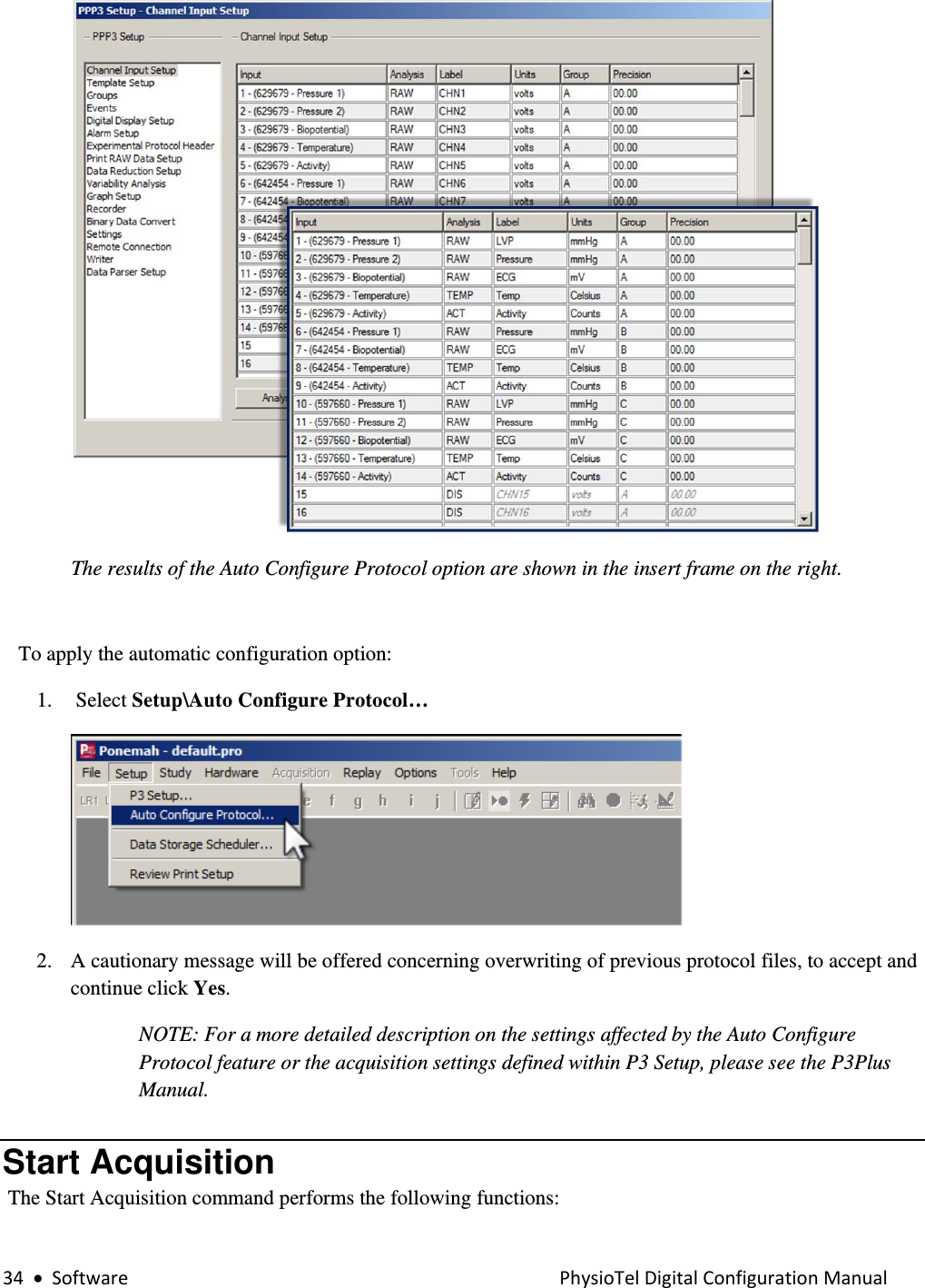 34•SoftwarePhysioTelDigitalConfigurationManualThe results of the Auto Configure Protocol option are shown in the insert frame on the right.     To apply the automatic configuration option: 1.  Select Setup\Auto Configure Protocol…  2. A cautionary message will be offered concerning overwriting of previous protocol files, to accept and continue click Yes. NOTE: For a more detailed description on the settings affected by the Auto Configure Protocol feature or the acquisition settings defined within P3 Setup, please see the P3Plus Manual. Start Acquisition  The Start Acquisition command performs the following functions: 