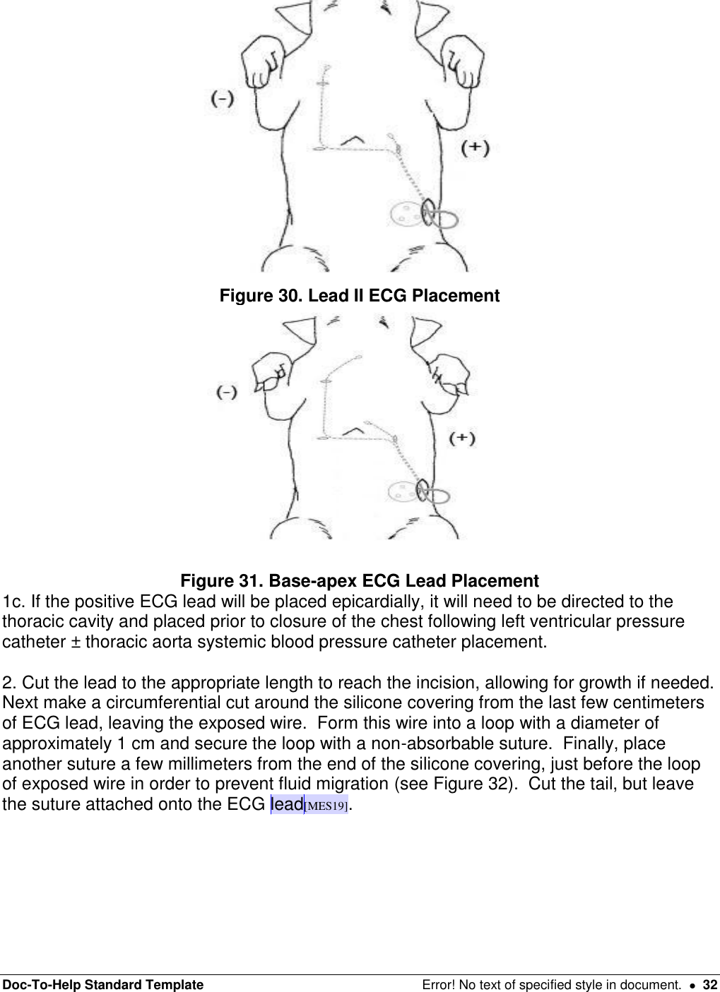 Doc-To-Help Standard Template  Error! No text of specified style in document.    32  Figure 30. Lead II ECG Placement   Figure 31. Base-apex ECG Lead Placement 1c. If the positive ECG lead will be placed epicardially, it will need to be directed to the thoracic cavity and placed prior to closure of the chest following left ventricular pressure catheter ± thoracic aorta systemic blood pressure catheter placement.   2. Cut the lead to the appropriate length to reach the incision, allowing for growth if needed.  Next make a circumferential cut around the silicone covering from the last few centimeters of ECG lead, leaving the exposed wire.  Form this wire into a loop with a diameter of approximately 1 cm and secure the loop with a non-absorbable suture.  Finally, place another suture a few millimeters from the end of the silicone covering, just before the loop of exposed wire in order to prevent fluid migration (see Figure 32).  Cut the tail, but leave the suture attached onto the ECG lead[MES19].  