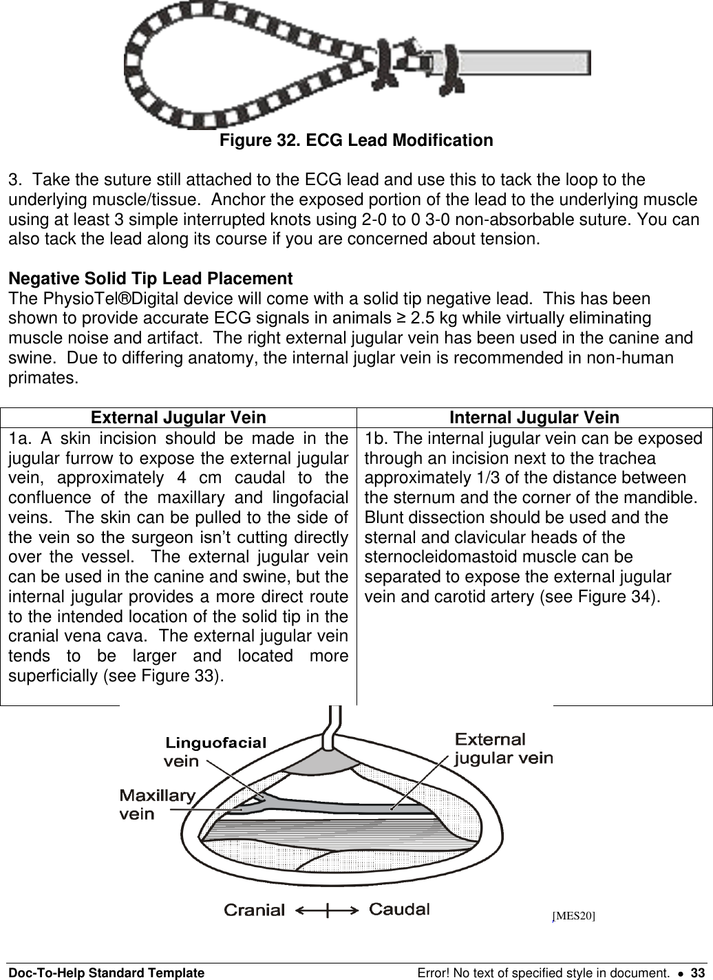 Doc-To-Help Standard Template  Error! No text of specified style in document.    33  Figure 32. ECG Lead Modification  3.  Take the suture still attached to the ECG lead and use this to tack the loop to the underlying muscle/tissue.  Anchor the exposed portion of the lead to the underlying muscle using at least 3 simple interrupted knots using 2-0 to 0 3-0 non-absorbable suture. You can also tack the lead along its course if you are concerned about tension.  Negative Solid Tip Lead Placement The PhysioTel®Digital device will come with a solid tip negative lead.  This has been shown to provide accurate ECG signals in animals ≥ 2.5 kg while virtually eliminating muscle noise and artifact.  The right external jugular vein has been used in the canine and swine.  Due to differing anatomy, the internal juglar vein is recommended in non-human primates.   External Jugular Vein Internal Jugular Vein 1a.  A  skin  incision  should  be  made  in  the jugular furrow to expose the external jugular vein,  approximately  4  cm  caudal  to  the confluence  of  the  maxillary  and  lingofacial veins.  The skin can be pulled to the side of the vein so the surgeon isn’t cutting directly over  the  vessel.    The  external  jugular  vein can be used in the canine and swine, but the internal jugular provides a more direct route to the intended location of the solid tip in the cranial vena cava.  The external jugular vein tends  to  be  larger  and  located  more superficially (see Figure 33).    1b. The internal jugular vein can be exposed through an incision next to the trachea approximately 1/3 of the distance between the sternum and the corner of the mandible.  Blunt dissection should be used and the sternal and clavicular heads of the sternocleidomastoid muscle can be separated to expose the external jugular vein and carotid artery (see Figure 34).    [MES20] 