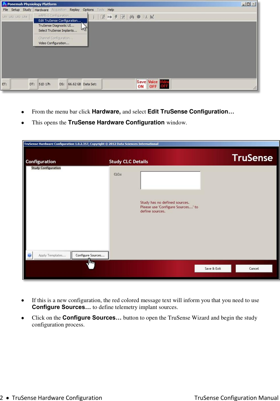  2     TruSense Hardware Configuration    TruSense Configuration Manual     From the menu bar click Hardware, and select Edit TruSense Configuration…   This opens the TruSense Hardware Configuration window.     If this is a new configuration, the red colored message text will inform you that you need to use Configure Sources… to define telemetry implant sources.  Click on the Configure Sources… button to open the TruSense Wizard and begin the study configuration process.     