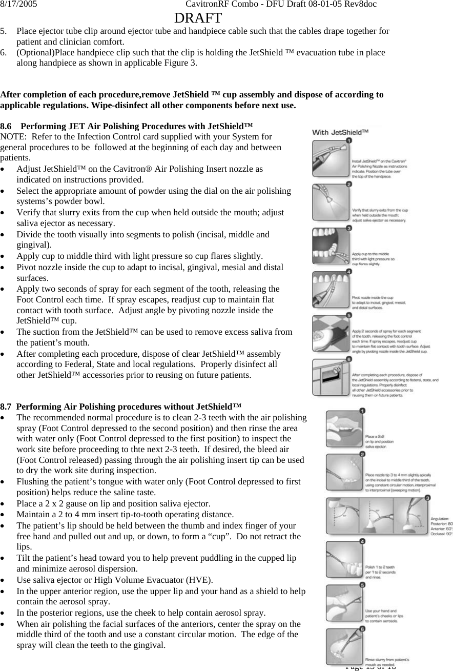 8/17/2005    CavitronRF Combo - DFU Draft 08-01-05 Rev8doc   DRAFT Page 13 of 18  5. Place ejector tube clip around ejector tube and handpiece cable such that the cables drape together for patient and clinician comfort. 6. (Optional)Place handpiece clip such that the clip is holding the JetShield ™ evacuation tube in place along handpiece as shown in applicable Figure 3.   After completion of each procedure,remove JetShield ™ cup assembly and dispose of according to applicable regulations. Wipe-disinfect all other components before next use.  8.6  Performing JET Air Polishing Procedures with JetShield™ NOTE:  Refer to the Infection Control card supplied with your System for general procedures to be  followed at the beginning of each day and between patients. • Adjust JetShield™ on the Cavitron® Air Polishing Insert nozzle as indicated on instructions provided. • Select the appropriate amount of powder using the dial on the air polishing systems’s powder bowl. • Verify that slurry exits from the cup when held outside the mouth; adjust saliva ejector as necessary. • Divide the tooth visually into segments to polish (incisal, middle and gingival). • Apply cup to middle third with light pressure so cup flares slightly. • Pivot nozzle inside the cup to adapt to incisal, gingival, mesial and distal surfaces. • Apply two seconds of spray for each segment of the tooth, releasing the Foot Control each time.  If spray escapes, readjust cup to maintain flat contact with tooth surface.  Adjust angle by pivoting nozzle inside the JetShield™ cup. • The suction from the JetShield™ can be used to remove excess saliva from the patient’s mouth. • After completing each procedure, dispose of clear JetShield™ assembly according to Federal, State and local regulations.  Properly disinfect all other JetShield™ accessories prior to reusing on future patients.   8.7  Performing Air Polishing procedures without JetShield™ • The recommended normal procedure is to clean 2-3 teeth with the air polishing spray (Foot Control depressed to the second position) and then rinse the area with water only (Foot Control depressed to the first position) to inspect the work site before proceeding to thte next 2-3 teeth.  If desired, the bleed air (Foot Control released) passing through the air polishing insert tip can be used to dry the work site during inspection. • Flushing the patient’s tongue with water only (Foot Control depressed to first position) helps reduce the saline taste. • Place a 2 x 2 gause on lip and position saliva ejector. • Maintain a 2 to 4 mm insert tip-to-tooth operating distance. • The patient’s lip should be held between the thumb and index finger of your free hand and pulled out and up, or down, to form a “cup”.  Do not retract the lips. • Tilt the patient’s head toward you to help prevent puddling in the cupped lip and minimize aerosol dispersion. • Use saliva ejector or High Volume Evacuator (HVE). • In the upper anterior region, use the upper lip and your hand as a shield to help contain the aerosol spray. • In the posterior regions, use the cheek to help contain aerosol spray. • When air polishing the facial surfaces of the anteriors, center the spray on the middle third of the tooth and use a constant circular motion.  The edge of the spray will clean the teeth to the gingival. 