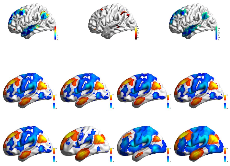 BrainNet Viewer Manual Brain Net