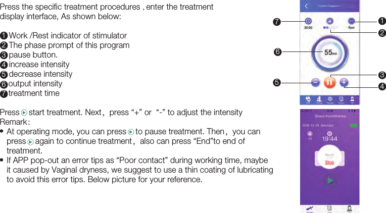 19Press the specific treatment procedures , enter the treatment display interface, As shown below:     Work /Rest indicator of stimulator     The phase prompt of this program     pause button.     increase intensity     decrease intensity     output intensity     treatment timePress    start treatment. Next，press “+” or  “-” to adjust the intensity Remark：    At operating mode, you can press    to pause treatment. Then，you can   press    again to continue treatment，also can press “End”to end of    treatment.   If APP pop-out an error tips as “Poor contact” during working time, maybe   it caused by Vaginal dryness, we suggest to use a thin coating of lubricating    to avoid this error tips. Below picture for your reference.   11234567423765