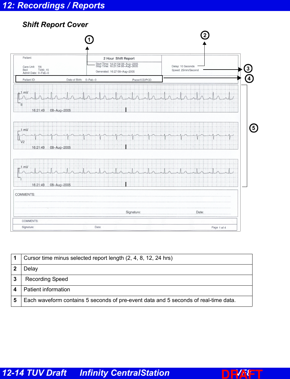 12-14 TUV Draft Infinity CentralStation VF812: Recordings / ReportsShift Report Cover1Cursor time minus selected report length (2, 4, 8, 12, 24 hrs) 2Delay3 Recording Speed4Patient information5Each waveform contains 5 seconds of pre-event data and 5 seconds of real-time data. DRAFT