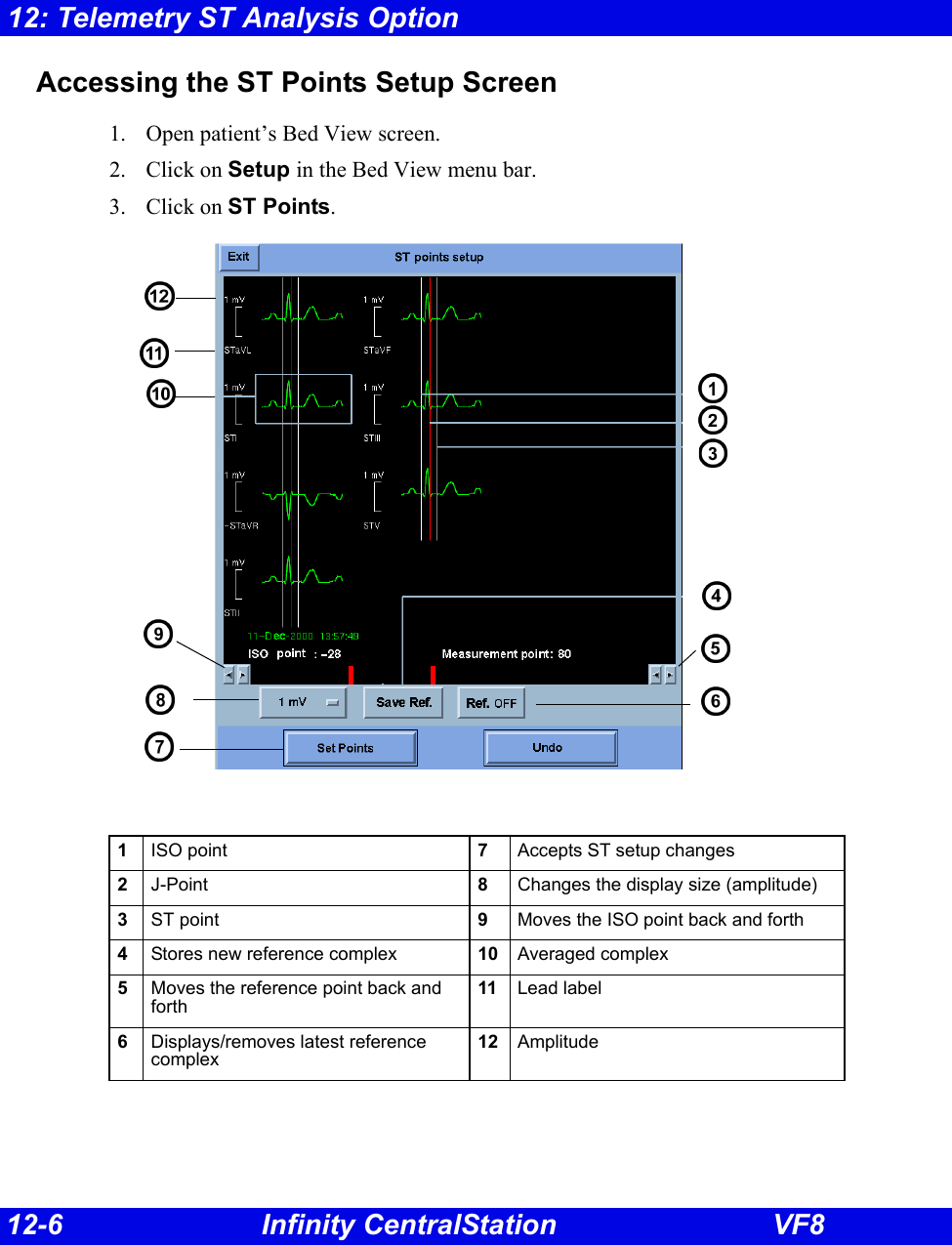12-6 Infinity CentralStation VF812: Telemetry ST Analysis OptionAccessing the ST Points Setup Screen1. Open patient’s Bed View screen.2. Click on Setup in the Bed View menu bar.3. Click on ST Points.1ISO point 7Accepts ST setup changes2J-Point 8Changes the display size (amplitude)3ST point 9Moves the ISO point back and forth4Stores new reference complex 10 Averaged complex5Moves the reference point back and forth11 Lead label6Displays/removes latest reference complex12 Amplitude