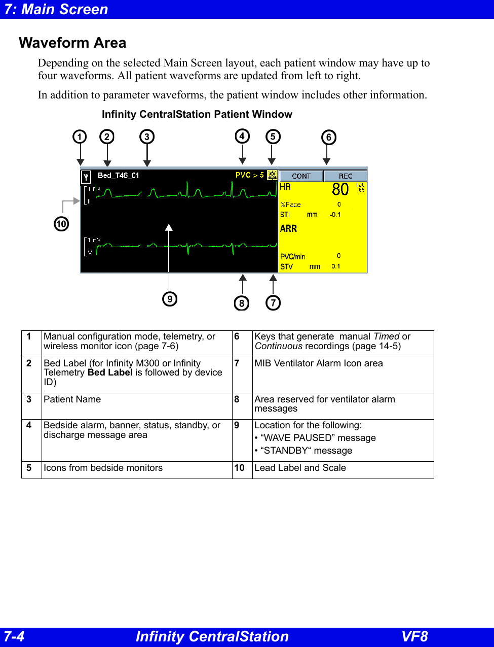 7-4 Infinity CentralStation VF87: Main ScreenWaveform AreaDepending on the selected Main Screen layout, each patient window may have up to four waveforms. All patient waveforms are updated from left to right. In addition to parameter waveforms, the patient window includes other information. Infinity CentralStation Patient Window  1 Manual configuration mode, telemetry, or wireless monitor icon (page 7-6)6Keys that generate  manual Timed or Continuous recordings (page 14-5) 2 Bed Label (for Infinity M300 or Infinity Tele metr y  Bed Label is followed by device ID)7MIB Ventilator Alarm Icon area 3 Patient Name 8Area reserved for ventilator alarm messages 4 Bedside alarm, banner, status, standby, or discharge message area9Location for the following:• “WAVE PAUSED” message• “STANDBY“ message 5 Icons from bedside monitors 10 Lead Label and Scale               