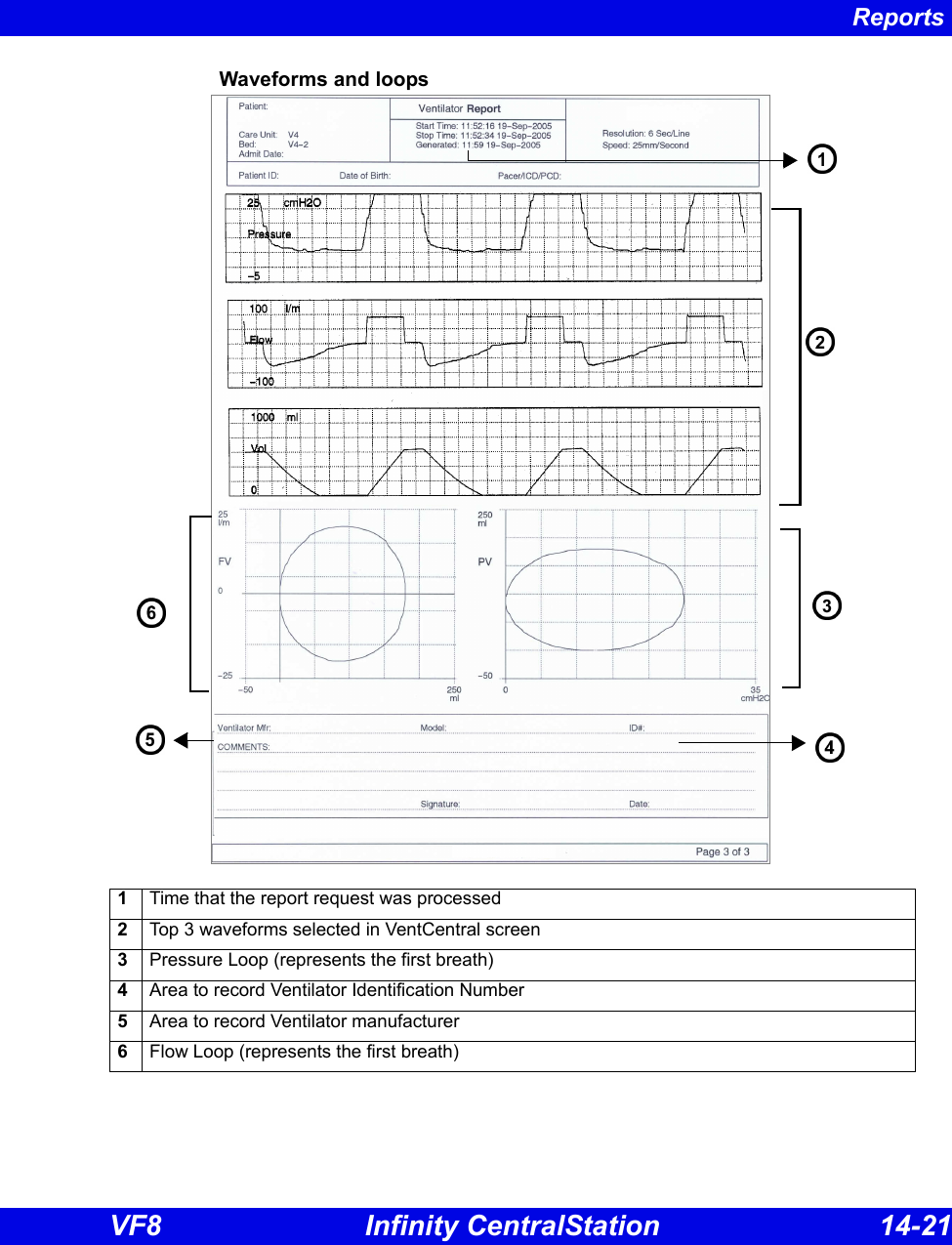Reports VF8 Infinity CentralStation 14-21 Waveforms and loops1Time that the report request was processed2Top 3 waveforms selected in VentCentral screen3Pressure Loop (represents the first breath)4Area to record Ventilator Identification Number5Area to record Ventilator manufacturer6Flow Loop (represents the first breath)