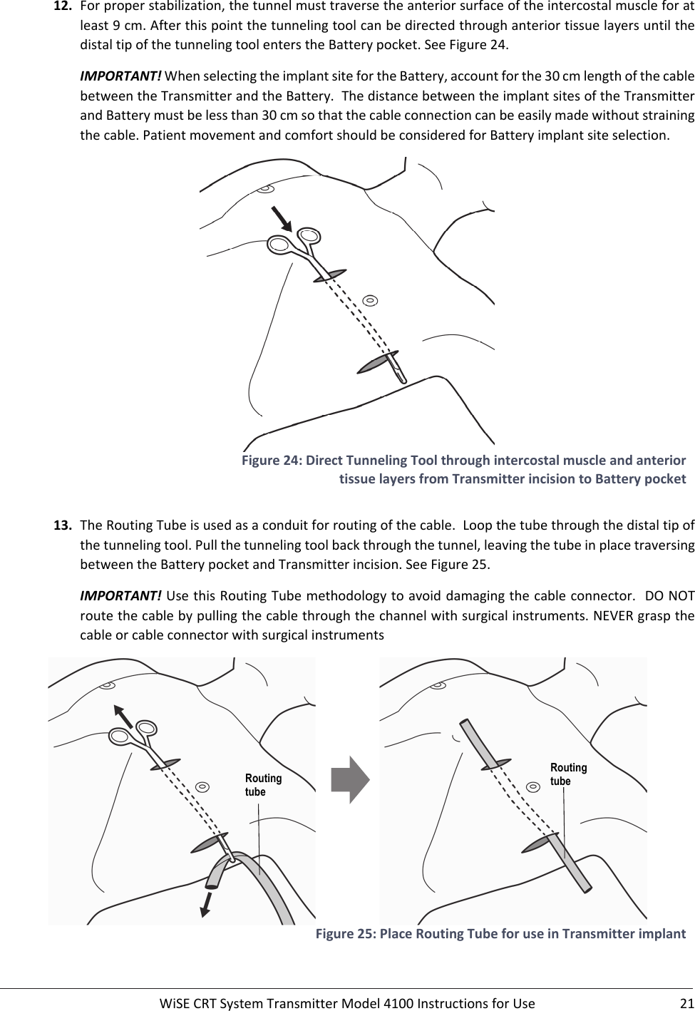  WiSECRTSystemTransmitterModel4100InstructionsforUse 2112. Forproperstabilization,thetunnelmusttraversetheanteriorsurfaceoftheintercostalmuscleforatleast9cm.AfterthispointthetunnelingtoolcanbedirectedthroughanteriortissuelayersuntilthedistaltipofthetunnelingtoolenterstheBatterypocket.SeeFigure24.IMPORTANT!WhenselectingtheimplantsitefortheBattery,accountforthe30cmlengthofthecablebetweentheTransmitterandtheBattery.ThedistancebetweentheimplantsitesoftheTransmitterandBatterymustbelessthan30cmsothatthecableconnectioncanbeeasilymadewithoutstrainingthecable.PatientmovementandcomfortshouldbeconsideredforBatteryimplantsiteselection.Figure24:DirectTunnelingToolthroughintercostalmuscleandanteriortissuelayersfromTransmitterincisiontoBatterypocket13. TheRoutingTubeisusedasaconduitforroutingofthecable.Loopthetubethroughthedistaltipofthetunnelingtool.Pullthetunnelingtoolbackthroughthetunnel,leavingthetubeinplacetraversingbetweentheBatterypocketandTransmitterincision.SeeFigure25.IMPORTANT!UsethisRoutingTubemethodologytoavoiddamagingthecableconnector.DONOTroutethecablebypullingthecablethroughthechannelwithsurgicalinstruments.NEVERgraspthecableorcableconnectorwithsurgicalinstruments Figure25:PlaceRoutingTubeforuseinTransmitterimplantRouting tube Routing tube 