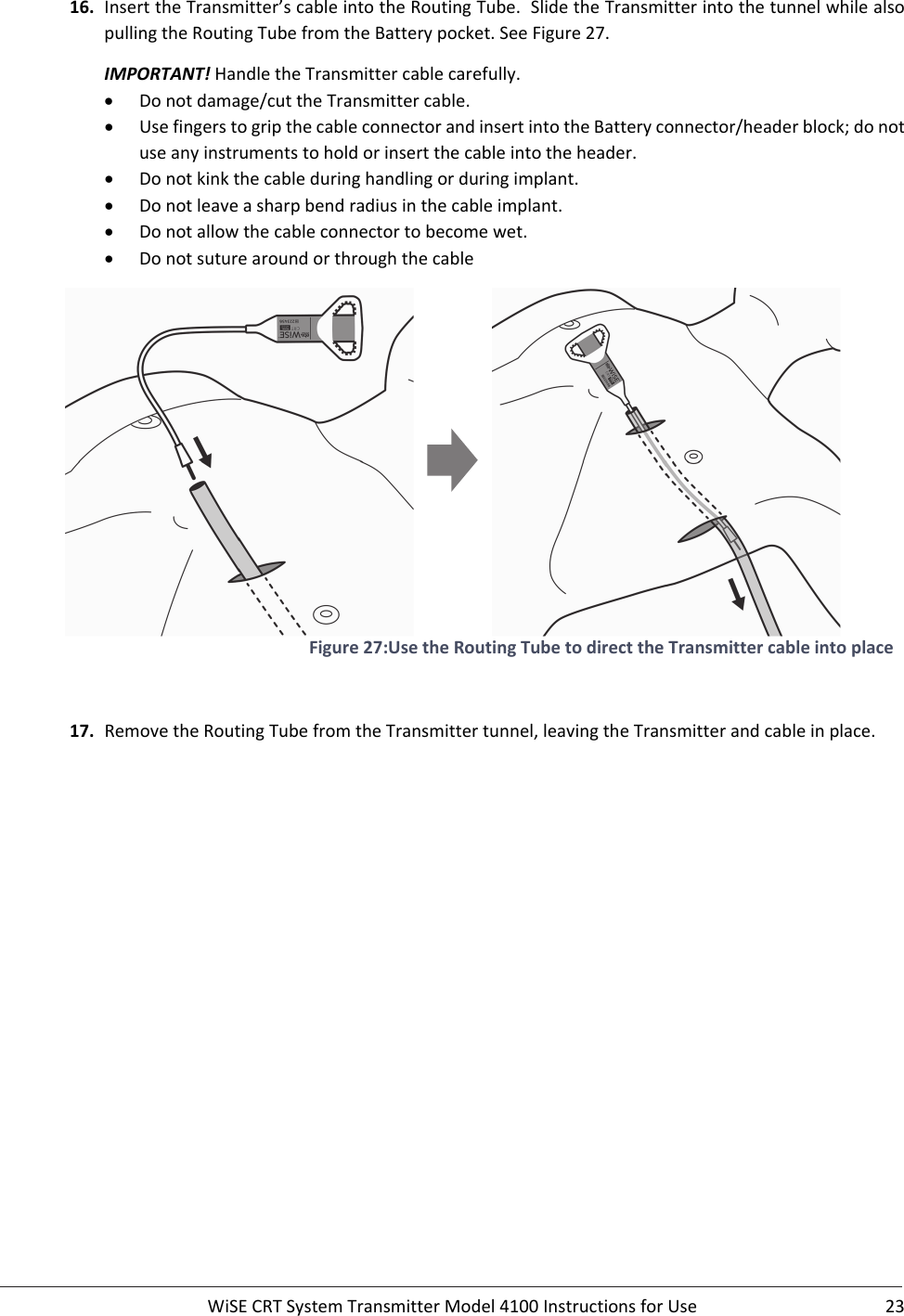  WiSECRTSystemTransmitterModel4100InstructionsforUse 2316. InserttheTransmitter’scableintotheRoutingTube.SlidetheTransmitterintothetunnelwhilealsopullingtheRoutingTubefromtheBatterypocket.SeeFigure27.IMPORTANT!HandletheTransmittercablecarefully. Donotdamage/cuttheTransmittercable. UsefingerstogripthecableconnectorandinsertintotheBatteryconnector/headerblock;donotuseanyinstrumentstoholdorinsertthecableintotheheader. Donotkinkthecableduringhandlingorduringimplant. Donotleaveasharpbendradiusinthecableimplant. Donotallowthecableconnectortobecomewet. Donotsuturearoundorthroughthecable Figure27:UsetheRoutingTubetodirecttheTransmittercableintoplace17. RemovetheRoutingTubefromtheTransmittertunnel,leavingtheTransmitterandcableinplace.