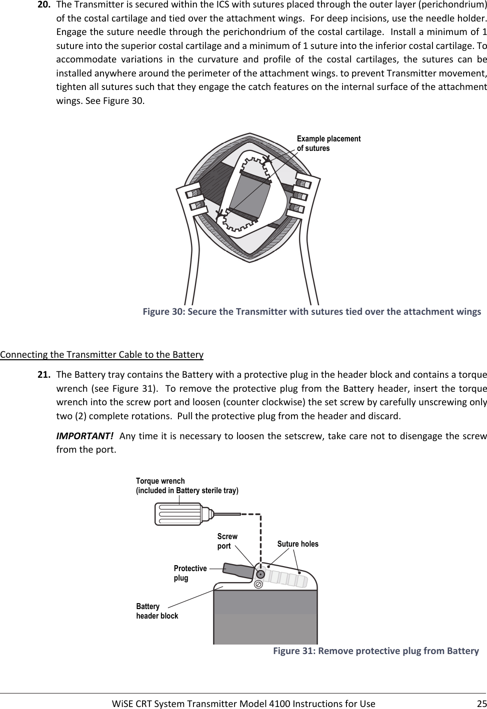  WiSECRTSystemTransmitterModel4100InstructionsforUse 2520. TheTransmitterissecuredwithintheICSwithsuturesplacedthroughtheouterlayer(perichondrium)ofthecostalcartilageandtiedovertheattachmentwings.Fordeepincisions,usetheneedleholder.Engagethesutureneedlethroughtheperichondriumofthecostalcartilage.Installaminimumof1sutureintothesuperiorcostalcartilageandaminimumof1sutureintotheinferiorcostalcartilage.Toaccommodate variations in the curvature and profile of the costal cartilages, the sutures can beinstalledanywherearoundtheperimeteroftheattachmentwings.topreventTransmittermovement,tightenallsuturessuchthattheyengagethecatchfeaturesontheinternalsurfaceoftheattachmentwings.SeeFigure30.Figure30:SecuretheTransmitterwithsuturestiedovertheattachmentwingsConnectingtheTransmitterCabletotheBattery21. TheBatterytraycontainstheBatterywithaprotectiveplugintheheaderblockandcontainsatorquewrench(seeFigure31).Toremovetheprotectiveplugfromthe Batteryheader,insertthetorquewrenchintothescrewportandloosen(counterclockwise)thesetscrewbycarefullyunscrewingonlytwo(2)completerotations.Pulltheprotectiveplugfromtheheaderanddiscard.IMPORTANT!Anytimeitisnecessarytoloosenthesetscrew,takecarenottodisengagethescrewfromtheport.Figure31:RemoveprotectiveplugfromBatteryExample placement of sutures Torque wrench (included in Battery sterile tray) Protective plug Screw port  Suture holes Battery  header block 