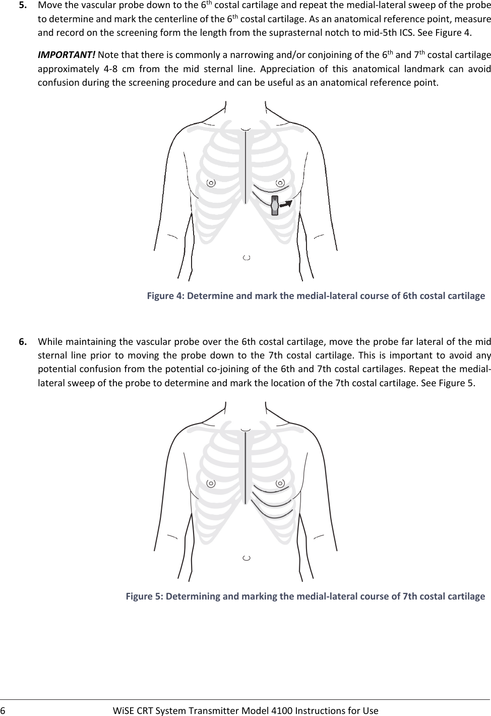 6 WiSECRTSystemTransmitterModel4100InstructionsforUse5. Movethevascularprobedowntothe6thcostalcartilageandrepeatthemedial‐lateralsweepoftheprobetodetermineandmarkthecenterlineofthe6thcostalcartilage.Asananatomicalreferencepoint,measureandrecordonthescreeningformthelengthfromthesuprasternalnotchtomid‐5thICS.SeeFigure4.IMPORTANT!Notethatthereiscommonlyanarrowingand/orconjoiningofthe6thand7thcostalcartilageapproximately 4‐8 cm from the mid sternal line. Appreciation of this anatomical landmark can avoidconfusionduringthescreeningprocedureandcanbeusefulasananatomicalreferencepoint.Figure4:Determineandmarkthemedial‐lateralcourseof6thcostalcartilage6. Whilemaintainingthevascularprobeoverthe6thcostalcartilage,movetheprobefarlateralofthemidsternal line prior to moving the probe down to the 7thcostal cartilage. This is important to avoid anypotentialconfusionfromthepotentialco‐joiningofthe6thand7thcostalcartilages.Repeatthemedial‐lateralsweepoftheprobetodetermineandmarkthelocationofthe7thcostalcartilage.SeeFigure5.Figure5:Determiningandmarkingthemedial‐lateralcourseof7thcostalcartilage