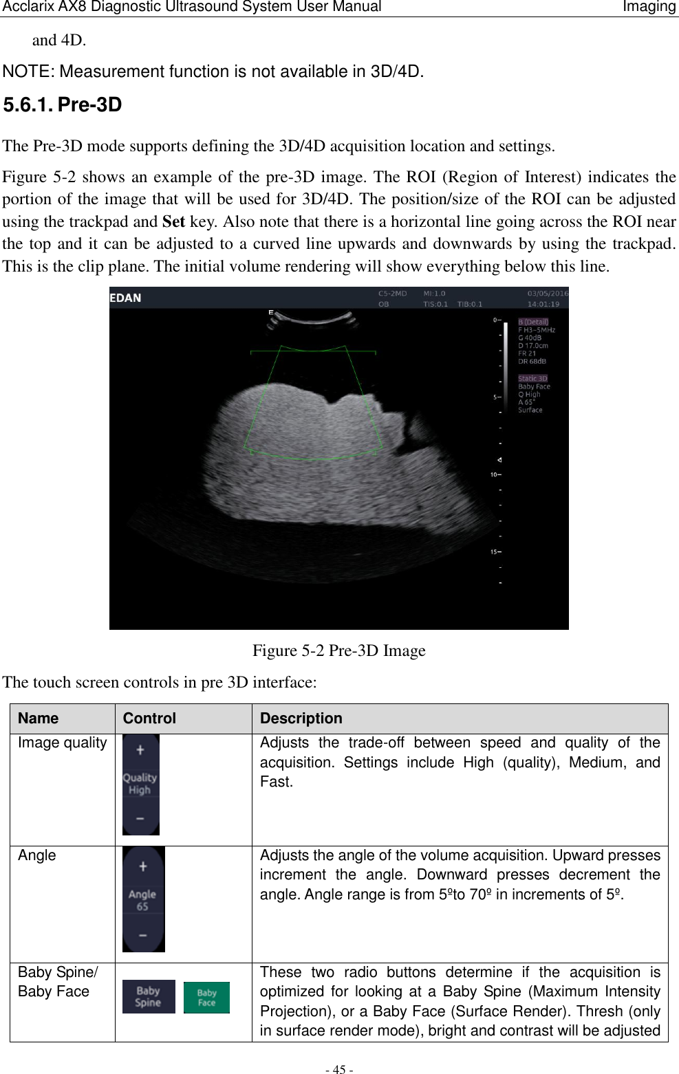 Acclarix AX8 Diagnostic Ultrasound System User Manual                                                                Imaging - 45 - and 4D. NOTE: Measurement function is not available in 3D/4D. 5.6.1. Pre-3D   The Pre-3D mode supports defining the 3D/4D acquisition location and settings. Figure 5-2 shows an example of the pre-3D image. The ROI (Region of Interest) indicates the portion of the image that will be used for 3D/4D. The position/size of the ROI can be adjusted using the trackpad and Set key. Also note that there is a horizontal line going across the ROI near the top and it can be adjusted to a curved line upwards and downwards by using the trackpad. This is the clip plane. The initial volume rendering will show everything below this line.    Figure 5-2 Pre-3D Image The touch screen controls in pre 3D interface: Name Control Description Image quality  Adjusts  the  trade-off  between  speed  and  quality  of  the acquisition.  Settings  include  High  (quality),  Medium,  and Fast. Angle  Adjusts the angle of the volume acquisition. Upward presses increment  the  angle.  Downward  presses  decrement  the angle. Angle range is from 5ºto 70º in increments of 5º.   Baby Spine/   Baby Face   These  two  radio  buttons  determine  if  the  acquisition  is optimized for  looking at a  Baby Spine (Maximum Intensity Projection), or a Baby Face (Surface Render). Thresh (only in surface render mode), bright and contrast will be adjusted 