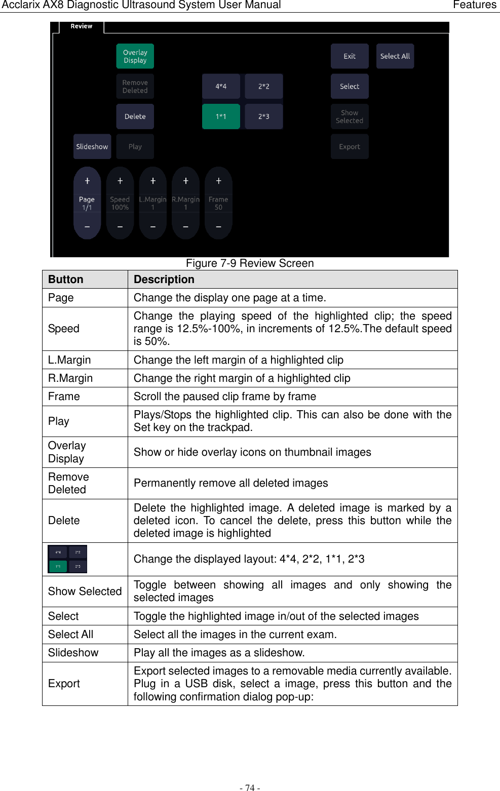 Acclarix AX8 Diagnostic Ultrasound System User Manual                                                              Features - 74 -  Figure 7-9 Review Screen Button Description Page Change the display one page at a time.   Speed Change  the  playing  speed  of  the  highlighted  clip;  the  speed range is 12.5%-100%, in increments of 12.5%.The default speed is 50%. L.Margin Change the left margin of a highlighted clip R.Margin Change the right margin of a highlighted clip Frame Scroll the paused clip frame by frame Play Plays/Stops the highlighted clip. This can also be done with the Set key on the trackpad. Overlay Display Show or hide overlay icons on thumbnail images Remove Deleted Permanently remove all deleted images Delete Delete the highlighted image. A deleted image  is  marked by a deleted  icon.  To  cancel  the  delete,  press  this  button  while  the deleted image is highlighted  Change the displayed layout: 4*4, 2*2, 1*1, 2*3 Show Selected Toggle  between  showing  all  images  and  only  showing  the selected images Select Toggle the highlighted image in/out of the selected images Select All Select all the images in the current exam. Slideshow Play all the images as a slideshow. Export Export selected images to a removable media currently available. Plug in  a USB disk, select a image, press this  button and  the following confirmation dialog pop-up: 