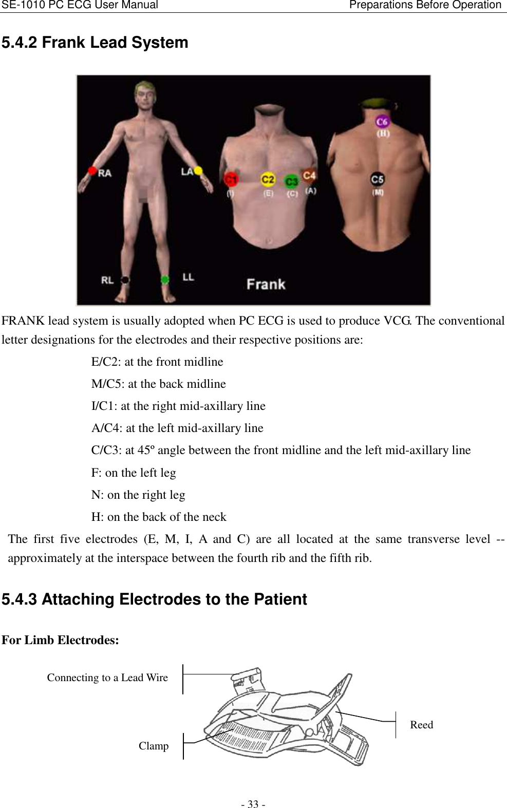 SE-1010 PC ECG User Manual                                                                    Preparations Before Operation - 33 - 5.4.2 Frank Lead System  FRANK lead system is usually adopted when PC ECG is used to produce VCG. The conventional letter designations for the electrodes and their respective positions are:                             E/C2: at the front midline                             M/C5: at the back midline                             I/C1: at the right mid-axillary line                             A/C4: at the left mid-axillary line                             C/C3: at 45º angle between the front midline and the left mid-axillary line                             F: on the left leg                             N: on the right leg                             H: on the back of the neck The  first  five  electrodes  (E,  M,  I,  A  and  C)  are  all  located  at  the  same  transverse  level  -- approximately at the interspace between the fourth rib and the fifth rib. 5.4.3 Attaching Electrodes to the Patient For Limb Electrodes:  Reed Connecting to a Lead Wire Clamp 