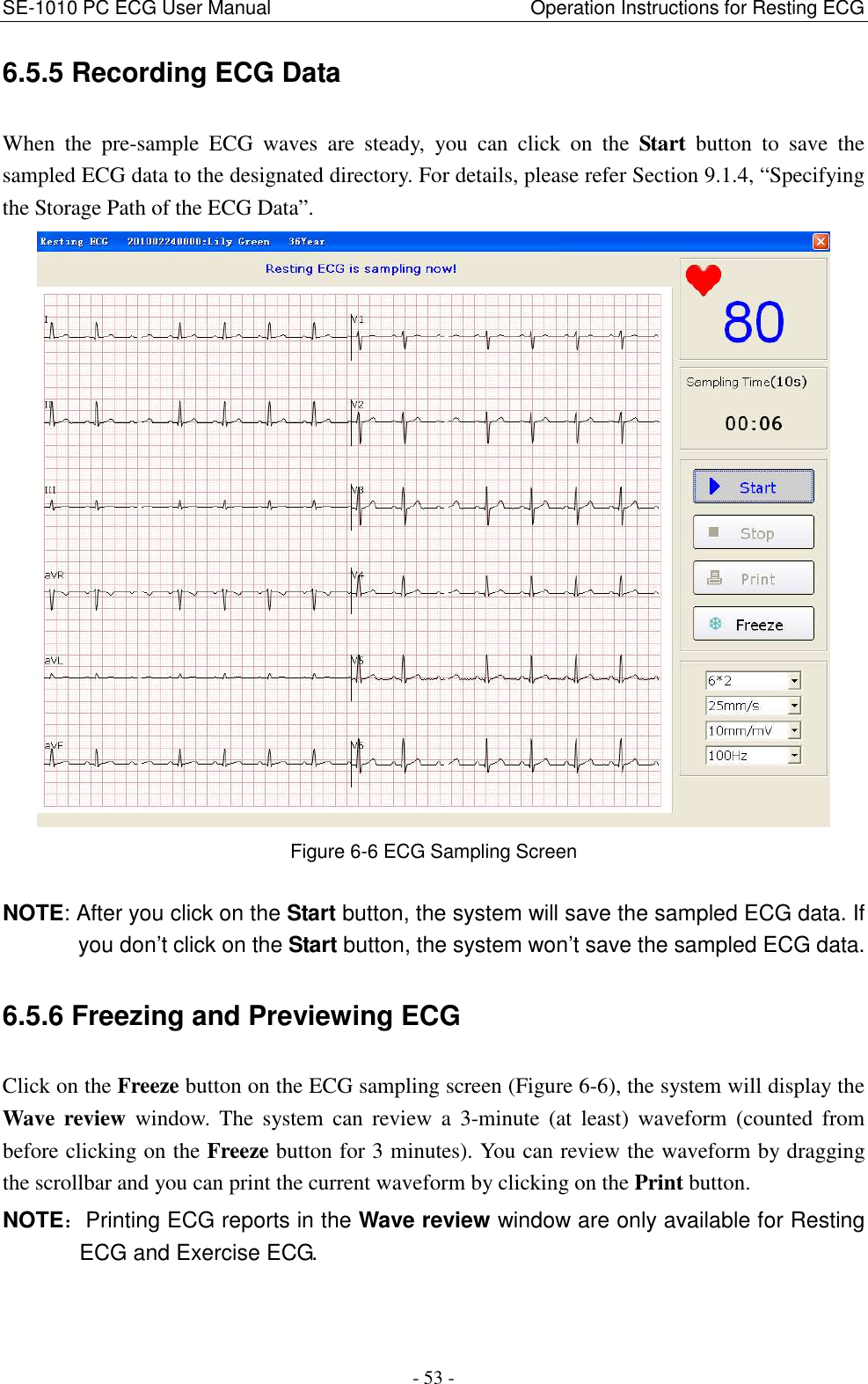 SE-1010 PC ECG User Manual                                                      Operation Instructions for Resting ECG - 53 - 6.5.5 Recording ECG Data When  the  pre-sample  ECG  waves  are  steady,  you  can  click  on  the  Start  button  to  save  the sampled ECG data to the designated directory. For details, please refer Section 9.1.4, “Specifying the Storage Path of the ECG Data”.  Figure 6-6 ECG Sampling Screen NOTE: After you click on the Start button, the system will save the sampled ECG data. If you don’t click on the Start button, the system won’t save the sampled ECG data. 6.5.6 Freezing and Previewing ECG Click on the Freeze button on the ECG sampling screen (Figure 6-6), the system will display the Wave review  window.  The  system  can  review  a  3-minute  (at  least)  waveform  (counted  from before clicking on the Freeze button for 3 minutes). You can review the waveform by dragging the scrollbar and you can print the current waveform by clicking on the Print button.     NOTE：Printing ECG reports in the Wave review window are only available for Resting ECG and Exercise ECG. 