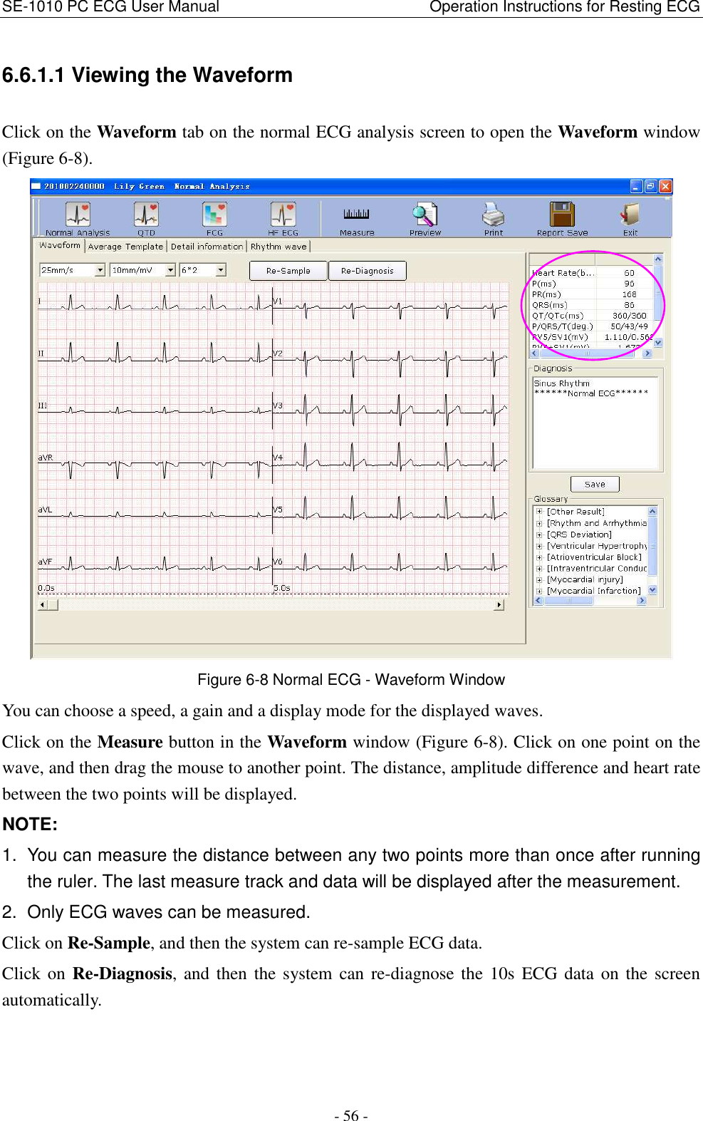 SE-1010 PC ECG User Manual                                                      Operation Instructions for Resting ECG - 56 - 6.6.1.1 Viewing the Waveform Click on the Waveform tab on the normal ECG analysis screen to open the Waveform window (Figure 6-8).  Figure 6-8 Normal ECG - Waveform Window You can choose a speed, a gain and a display mode for the displayed waves. Click on the Measure button in the Waveform window (Figure 6-8). Click on one point on the wave, and then drag the mouse to another point. The distance, amplitude difference and heart rate between the two points will be displayed. NOTE: 1.  You can measure the distance between any two points more than once after running the ruler. The last measure track and data will be displayed after the measurement. 2.  Only ECG waves can be measured. Click on Re-Sample, and then the system can re-sample ECG data. Click on Re-Diagnosis, and then the system can re-diagnose the 10s ECG data on the screen automatically. 