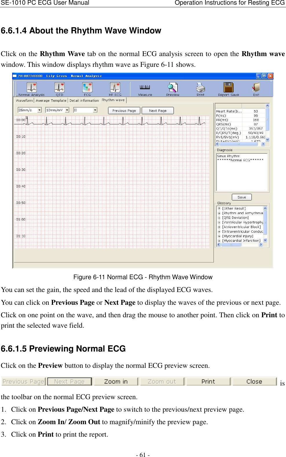 SE-1010 PC ECG User Manual                                                      Operation Instructions for Resting ECG - 61 - 6.6.1.4 About the Rhythm Wave Window Click on the Rhythm Wave tab on the normal ECG analysis screen to open the Rhythm wave window. This window displays rhythm wave as Figure 6-11 shows.  Figure 6-11 Normal ECG - Rhythm Wave Window You can set the gain, the speed and the lead of the displayed ECG waves.   You can click on Previous Page or Next Page to display the waves of the previous or next page. Click on one point on the wave, and then drag the mouse to another point. Then click on Print to print the selected wave field. 6.6.1.5 Previewing Normal ECG Click on the Preview button to display the normal ECG preview screen. is the toolbar on the normal ECG preview screen. 1. Click on Previous Page/Next Page to switch to the previous/next preview page. 2. Click on Zoom In/ Zoom Out to magnify/minify the preview page. 3. Click on Print to print the report. 