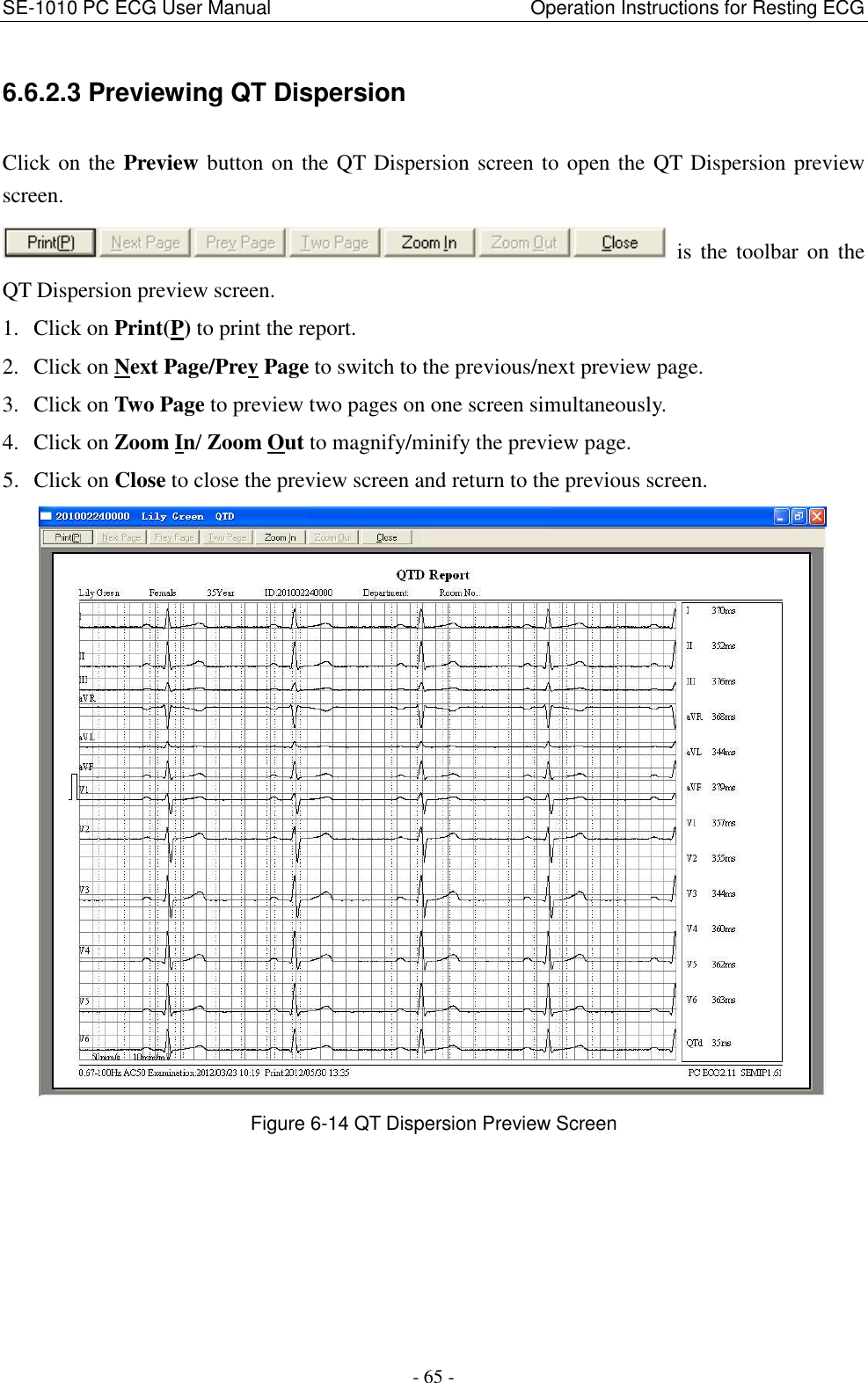 SE-1010 PC ECG User Manual                                                      Operation Instructions for Resting ECG - 65 - 6.6.2.3 Previewing QT Dispersion Click on the Preview button on the QT Dispersion screen to open the QT Dispersion preview screen.   is  the  toolbar  on  the QT Dispersion preview screen. 1. Click on Print(P) to print the report. 2. Click on Next Page/Prev Page to switch to the previous/next preview page. 3. Click on Two Page to preview two pages on one screen simultaneously. 4. Click on Zoom In/ Zoom Out to magnify/minify the preview page. 5. Click on Close to close the preview screen and return to the previous screen.  Figure 6-14 QT Dispersion Preview Screen 