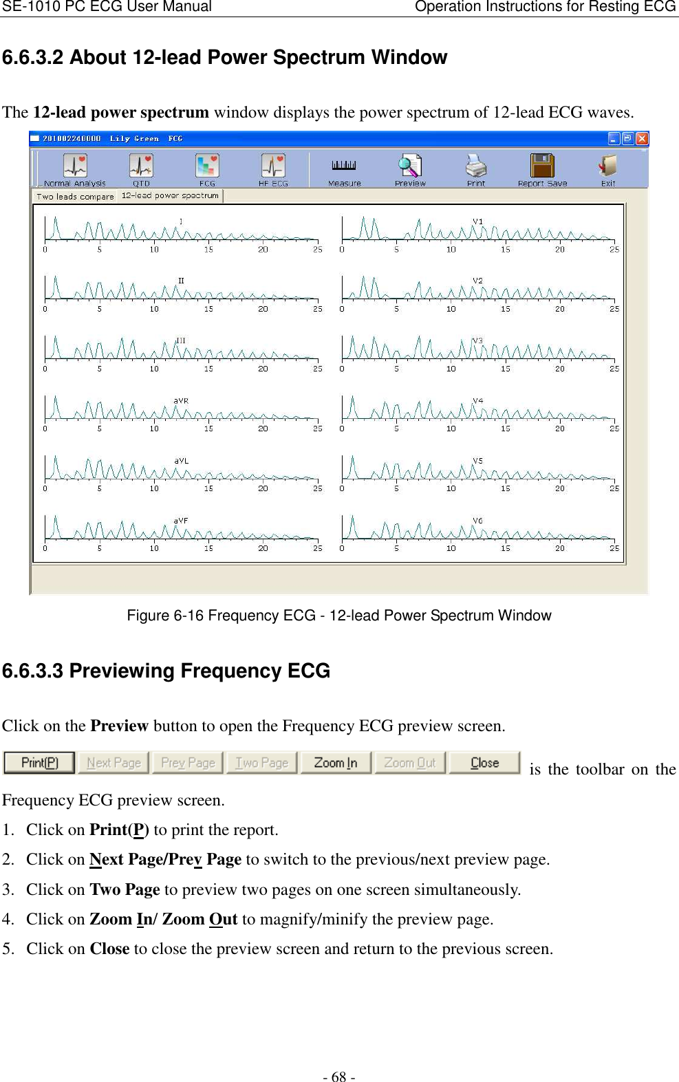 SE-1010 PC ECG User Manual                                                      Operation Instructions for Resting ECG - 68 - 6.6.3.2 About 12-lead Power Spectrum Window The 12-lead power spectrum window displays the power spectrum of 12-lead ECG waves.  Figure 6-16 Frequency ECG - 12-lead Power Spectrum Window 6.6.3.3 Previewing Frequency ECG Click on the Preview button to open the Frequency ECG preview screen.   is  the  toolbar  on  the Frequency ECG preview screen. 1. Click on Print(P) to print the report. 2. Click on Next Page/Prev Page to switch to the previous/next preview page. 3. Click on Two Page to preview two pages on one screen simultaneously. 4. Click on Zoom In/ Zoom Out to magnify/minify the preview page. 5. Click on Close to close the preview screen and return to the previous screen. 