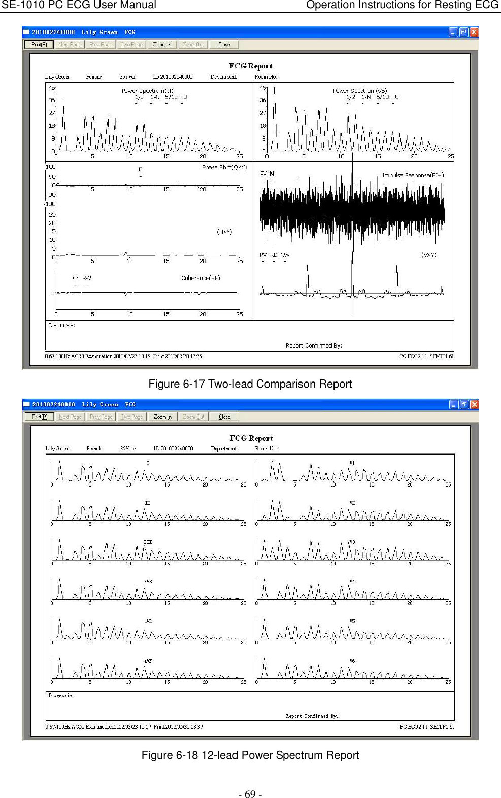 SE-1010 PC ECG User Manual                                                      Operation Instructions for Resting ECG - 69 -  Figure 6-17 Two-lead Comparison Report  Figure 6-18 12-lead Power Spectrum Report 