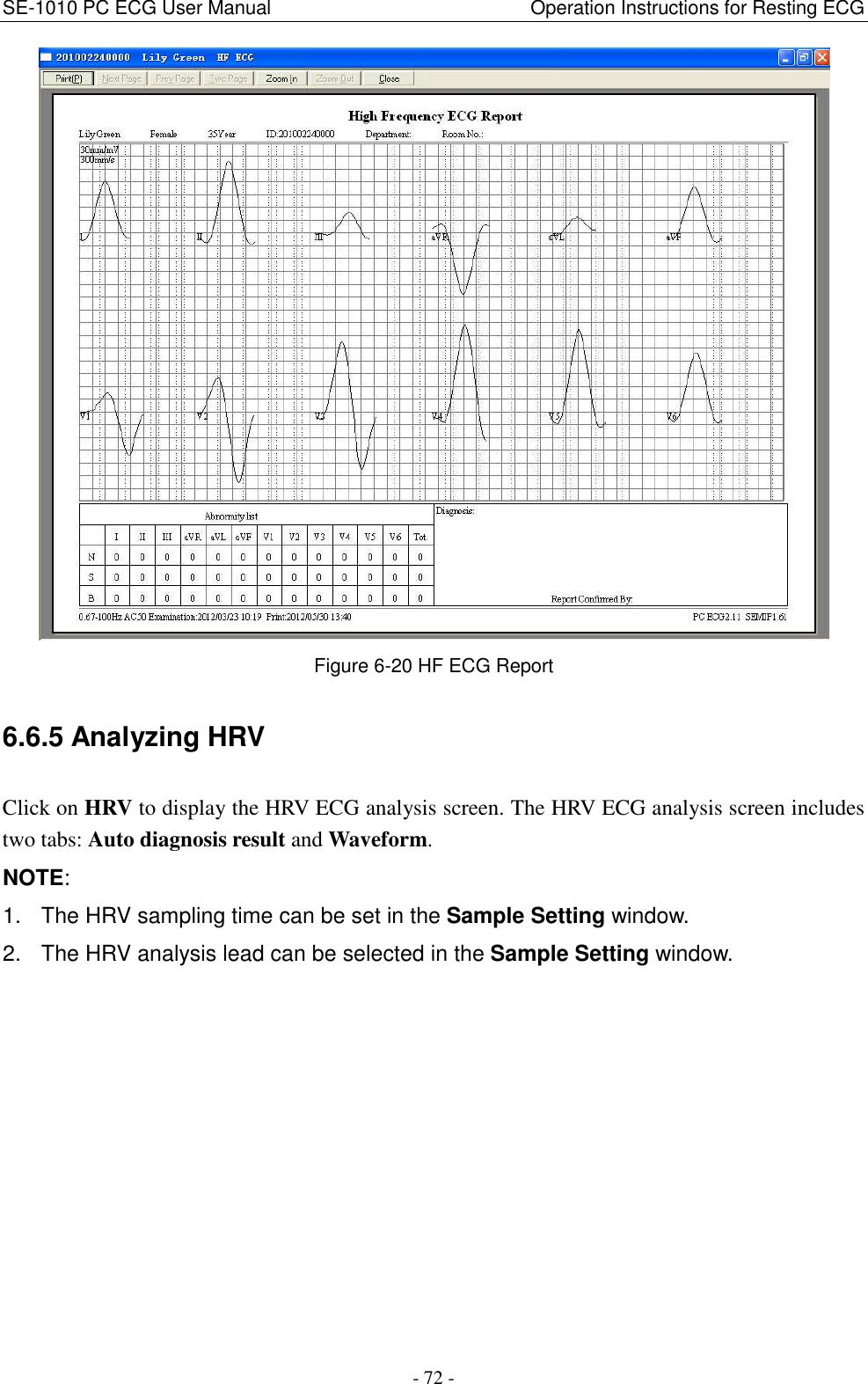 SE-1010 PC ECG User Manual                                                      Operation Instructions for Resting ECG - 72 -  Figure 6-20 HF ECG Report 6.6.5 Analyzing HRV Click on HRV to display the HRV ECG analysis screen. The HRV ECG analysis screen includes two tabs: Auto diagnosis result and Waveform. NOTE: 1.  The HRV sampling time can be set in the Sample Setting window. 2.  The HRV analysis lead can be selected in the Sample Setting window. 