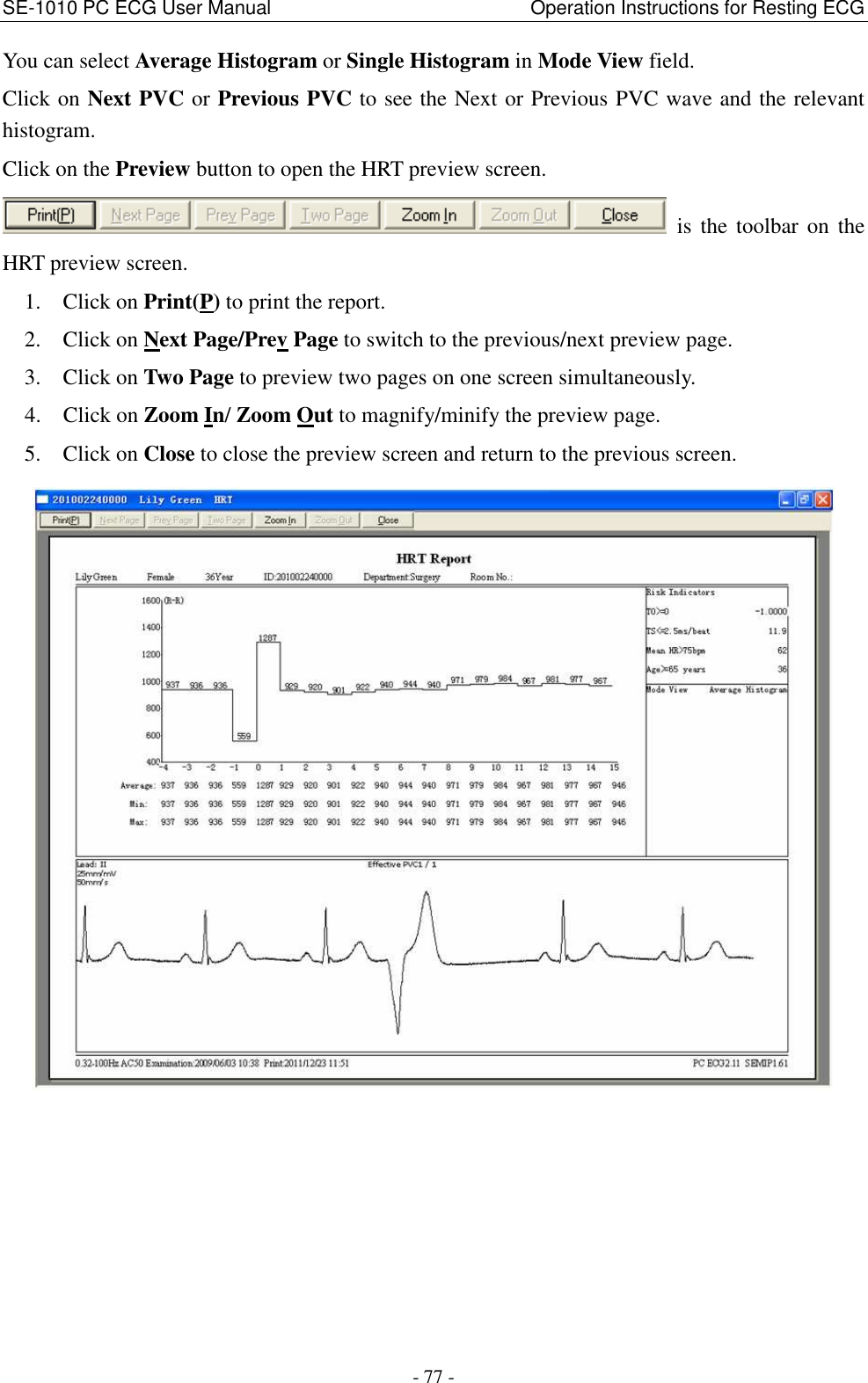 SE-1010 PC ECG User Manual                                                      Operation Instructions for Resting ECG - 77 - You can select Average Histogram or Single Histogram in Mode View field. Click on Next PVC or Previous PVC to see the Next or Previous PVC wave and the relevant histogram. Click on the Preview button to open the HRT preview screen.   is  the  toolbar  on  the HRT preview screen. 1. Click on Print(P) to print the report. 2. Click on Next Page/Prev Page to switch to the previous/next preview page. 3. Click on Two Page to preview two pages on one screen simultaneously. 4. Click on Zoom In/ Zoom Out to magnify/minify the preview page. 5. Click on Close to close the preview screen and return to the previous screen.  