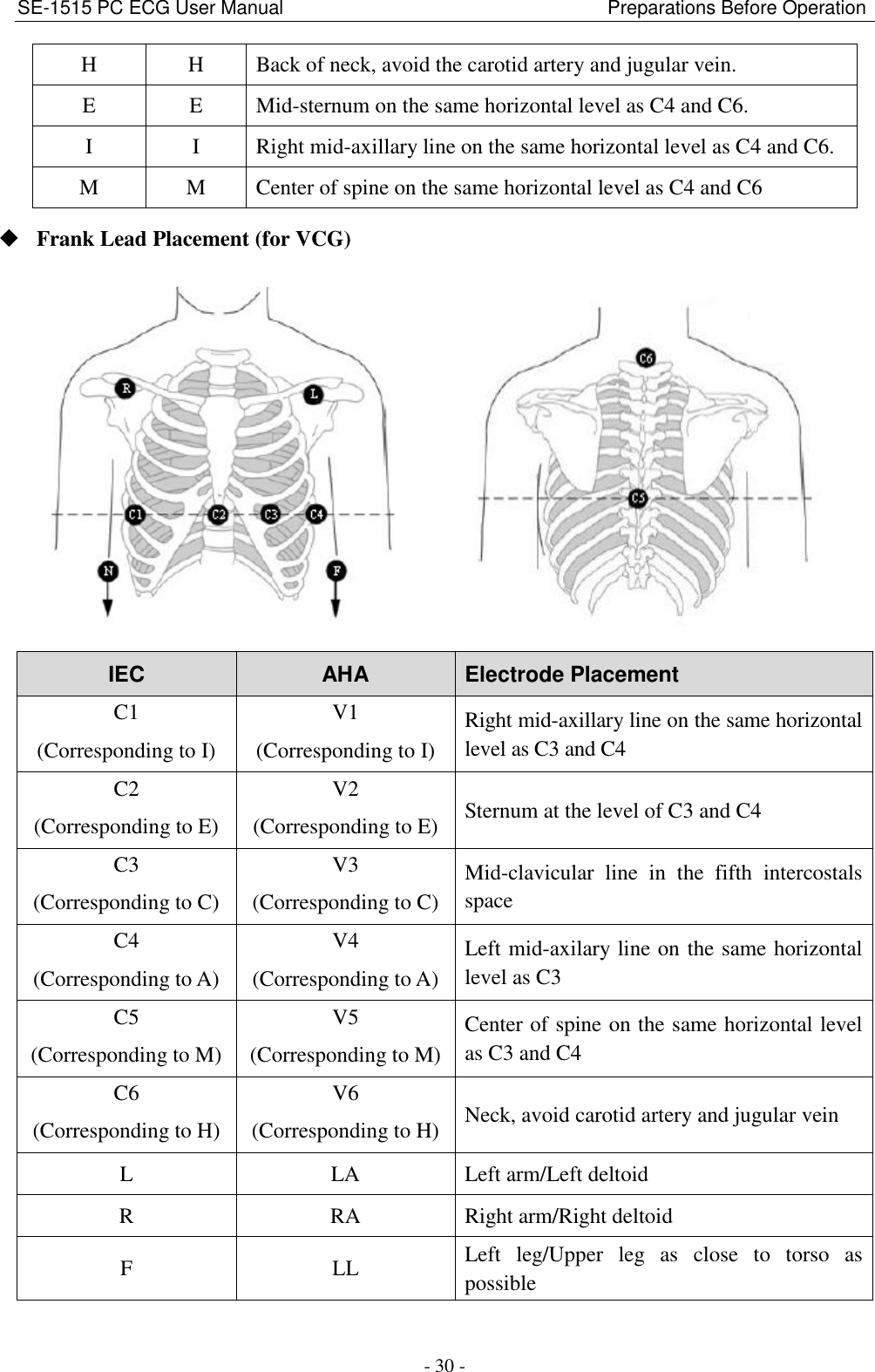 SE-1515 PC ECG User Manual                                                                    Preparations Before Operation - 30 - H H Back of neck, avoid the carotid artery and jugular vein. E E Mid-sternum on the same horizontal level as C4 and C6. I I Right mid-axillary line on the same horizontal level as C4 and C6. M M Center of spine on the same horizontal level as C4 and C6  Frank Lead Placement (for VCG)        IEC AHA Electrode Placement C1 (Corresponding to I) V1 (Corresponding to I) Right mid-axillary line on the same horizontal level as C3 and C4 C2 (Corresponding to E) V2 (Corresponding to E) Sternum at the level of C3 and C4 C3 (Corresponding to C) V3 (Corresponding to C) Mid-clavicular  line  in  the  fifth  intercostals space C4 (Corresponding to A) V4 (Corresponding to A) Left mid-axilary line on the same horizontal level as C3 C5 (Corresponding to M) V5 (Corresponding to M) Center of spine on the same horizontal level as C3 and C4 C6 (Corresponding to H) V6 (Corresponding to H) Neck, avoid carotid artery and jugular vein L LA Left arm/Left deltoid   R RA Right arm/Right deltoid F LL Left  leg/Upper  leg  as  close  to  torso  as possible   