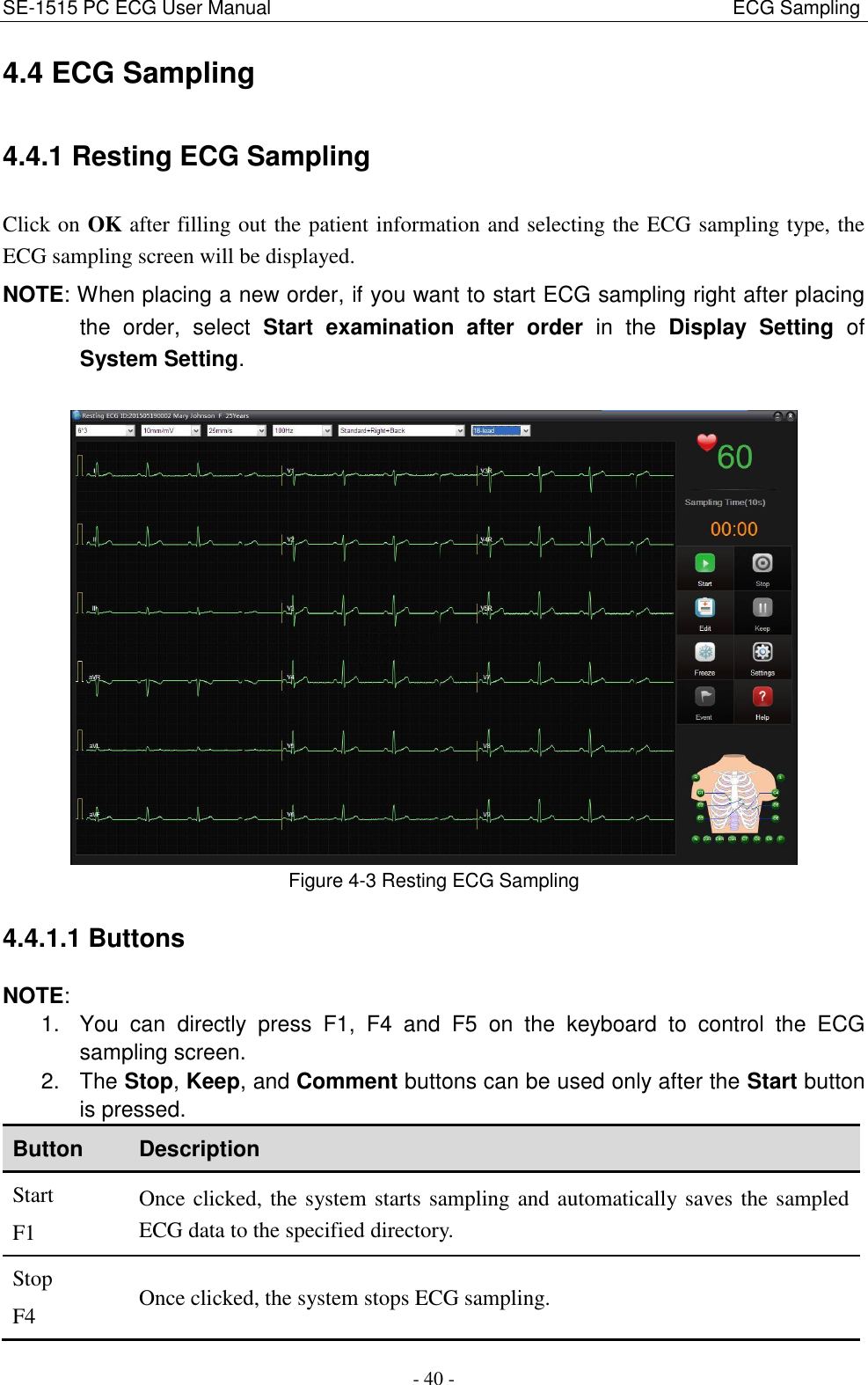 SE-1515 PC ECG User Manual                                                                                              ECG Sampling - 40 - 4.4 ECG Sampling 4.4.1 Resting ECG Sampling Click on OK after filling out the patient information and selecting the ECG sampling type, the ECG sampling screen will be displayed. NOTE: When placing a new order, if you want to start ECG sampling right after placing the  order,  select  Start  examination  after  order  in  the  Display  Setting  of System Setting.   Figure 4-3 Resting ECG Sampling 4.4.1.1 Buttons NOTE:   1.  You  can  directly  press  F1,  F4  and  F5  on  the  keyboard  to  control  the  ECG sampling screen. 2.  The Stop, Keep, and Comment buttons can be used only after the Start button is pressed. Button Description Start F1 Once clicked, the system starts sampling and automatically saves the sampled ECG data to the specified directory. Stop F4 Once clicked, the system stops ECG sampling. 
