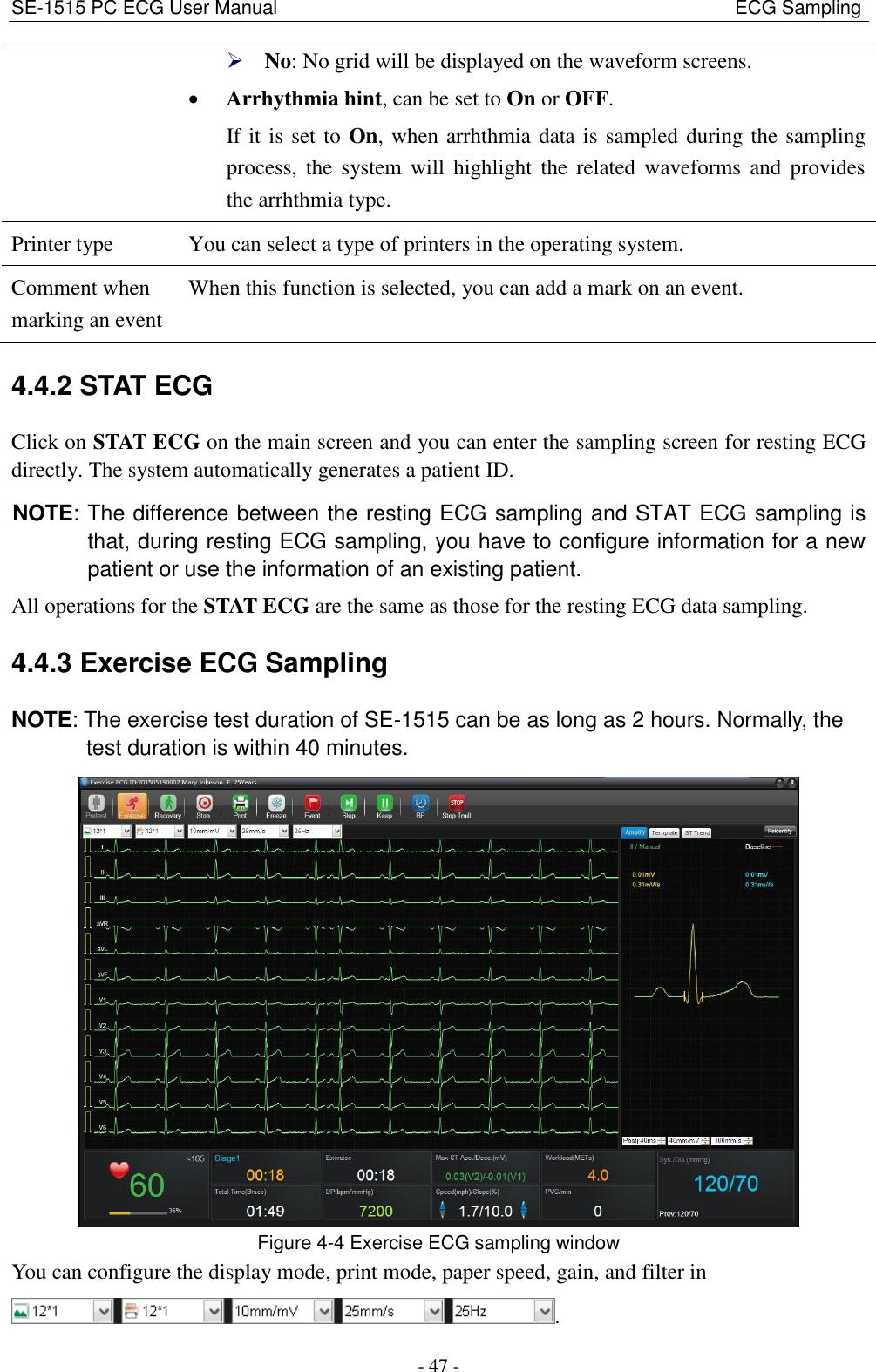 SE-1515 PC ECG User Manual                                                                                              ECG Sampling - 47 -  No: No grid will be displayed on the waveform screens.  Arrhythmia hint, can be set to On or OFF. If it is set to On, when arrhthmia data is sampled during the sampling process, the  system  will  highlight  the  related  waveforms  and  provides the arrhthmia type. Printer type You can select a type of printers in the operating system. Comment when marking an event When this function is selected, you can add a mark on an event. 4.4.2 STAT ECG Click on STAT ECG on the main screen and you can enter the sampling screen for resting ECG directly. The system automatically generates a patient ID. NOTE: The difference between the resting ECG sampling and STAT ECG sampling is that, during resting ECG sampling, you have to configure information for a new patient or use the information of an existing patient. All operations for the STAT ECG are the same as those for the resting ECG data sampling. 4.4.3 Exercise ECG Sampling NOTE: The exercise test duration of SE-1515 can be as long as 2 hours. Normally, the test duration is within 40 minutes.  Figure 4-4 Exercise ECG sampling window You can configure the display mode, print mode, paper speed, gain, and filter in   . 