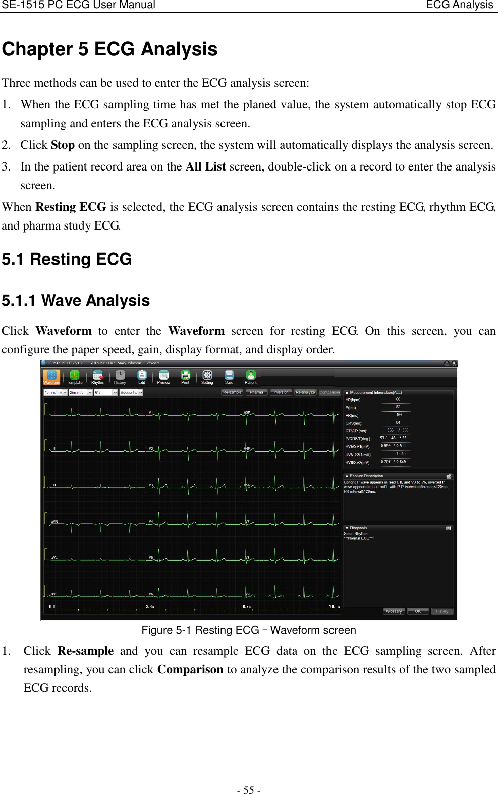 SE-1515 PC ECG User Manual                                                                                                  ECG Analysis - 55 - Chapter 5 ECG Analysis Three methods can be used to enter the ECG analysis screen: 1. When the ECG sampling time has met the planed value, the system automatically stop ECG sampling and enters the ECG analysis screen. 2. Click Stop on the sampling screen, the system will automatically displays the analysis screen. 3. In the patient record area on the All List screen, double-click on a record to enter the analysis screen.   When Resting ECG is selected, the ECG analysis screen contains the resting ECG, rhythm ECG, and pharma study ECG. 5.1 Resting ECG 5.1.1 Wave Analysis Click  Waveform  to  enter  the  Waveform  screen  for  resting  ECG.  On  this  screen,  you  can configure the paper speed, gain, display format, and display order.  Figure 5-1 Resting ECG–Waveform screen 1. Click  Re-sample  and  you  can  resample  ECG  data  on  the  ECG  sampling  screen.  After resampling, you can click Comparison to analyze the comparison results of the two sampled ECG records. 