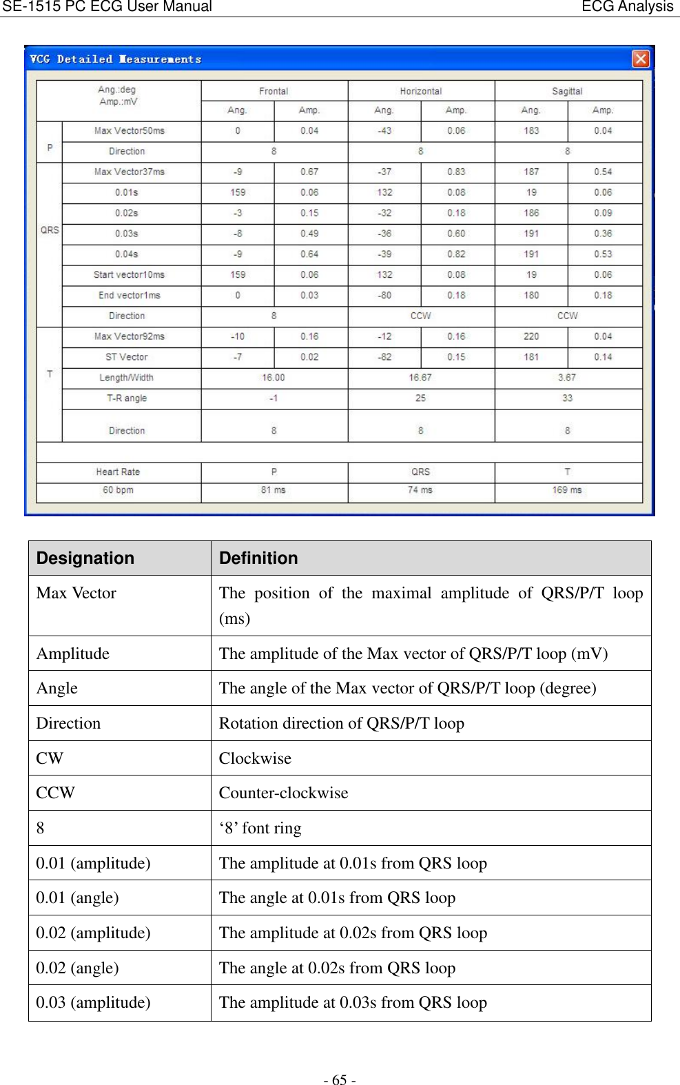 SE-1515 PC ECG User Manual                                                                                                  ECG Analysis - 65 -   Designation Definition Max Vector The  position  of  the  maximal  amplitude  of  QRS/P/T  loop (ms) Amplitude The amplitude of the Max vector of QRS/P/T loop (mV) Angle The angle of the Max vector of QRS/P/T loop (degree) Direction Rotation direction of QRS/P/T loop CW Clockwise CCW Counter-clockwise 8 ‘8’ font ring 0.01 (amplitude) The amplitude at 0.01s from QRS loop 0.01 (angle) The angle at 0.01s from QRS loop 0.02 (amplitude) The amplitude at 0.02s from QRS loop 0.02 (angle) The angle at 0.02s from QRS loop 0.03 (amplitude) The amplitude at 0.03s from QRS loop 