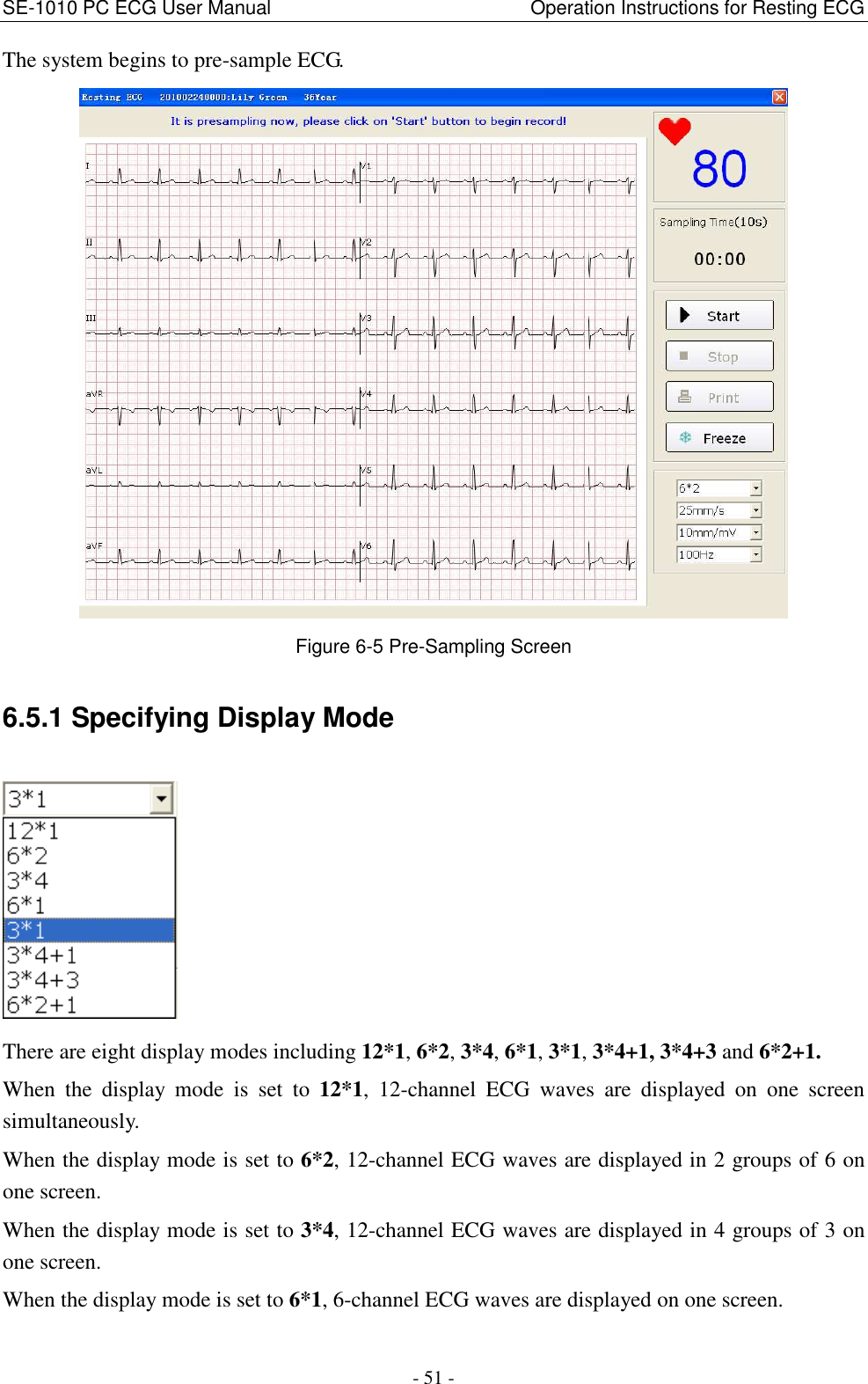 SE-1010 PC ECG User Manual                                                      Operation Instructions for Resting ECG - 51 - The system begins to pre-sample ECG.  Figure 6-5 Pre-Sampling Screen 6.5.1 Specifying Display Mode  There are eight display modes including 12*1, 6*2, 3*4, 6*1, 3*1, 3*4+1, 3*4+3 and 6*2+1. When  the  display  mode  is  set  to  12*1,  12-channel  ECG  waves  are  displayed  on  one  screen simultaneously. When the display mode is set to 6*2, 12-channel ECG waves are displayed in 2 groups of 6 on one screen. When the display mode is set to 3*4, 12-channel ECG waves are displayed in 4 groups of 3 on one screen. When the display mode is set to 6*1, 6-channel ECG waves are displayed on one screen. 