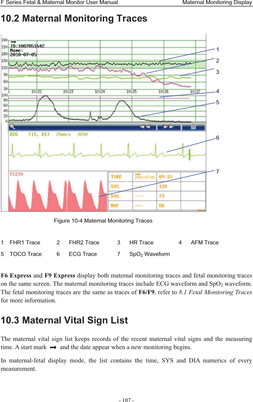 F Series Fetal &amp; Maternal Monitor User Manual                       Maternal Monitoring Display - 107 - 10.2 Maternal Monitoring Traces  Figure 10-4 Maternal Monitoring Traces  1  FHR1 Trace  2  FHR2 Trace  3  HR Trace  4  AFM Trace 5  TOCO Trace  6  ECG Trace  7  SpO2 Waveform      F6 Express and F9 Express display both maternal monitoring traces and fetal monitoring traces on the same screen. The maternal monitoring traces include ECG waveform and SpO2 waveform. The fetal monitoring traces are the same as traces of F6/F9, refer to 8.1 Fetal Monitoring Traces for more information. 10.3 Maternal Vital Sign List The maternal vital sign list keeps records of the recent maternal vital signs and the measuring time. A start mark    and the date appear when a new monitoring begins. In maternal-fetal display mode, the list contains the time, SYS and DIA numerics of every measurement. 1 2 3 4 5   6  7 