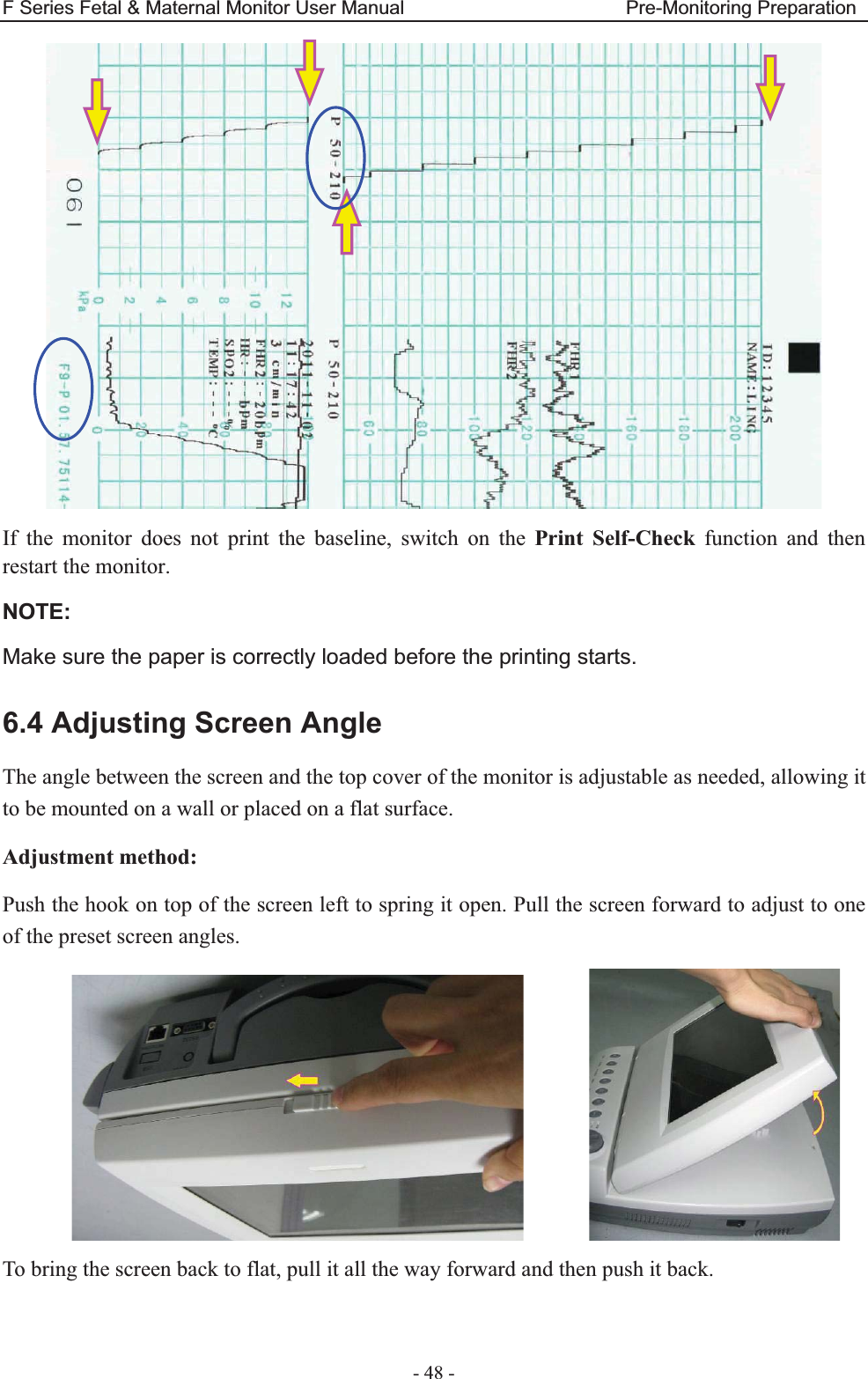 F Series Fetal &amp; Maternal Monitor User Manual                       Pre-Monitoring Preparation - 48 -  If the monitor does not print the baseline, switch on the Print Self-Check function and then restart the monitor. NOTE:Make sure the paper is correctly loaded before the printing starts. 6.4 Adjusting Screen Angle The angle between the screen and the top cover of the monitor is adjustable as needed, allowing it to be mounted on a wall or placed on a flat surface. Adjustment method: Push the hook on top of the screen left to spring it open. Pull the screen forward to adjust to one of the preset screen angles.         To bring the screen back to flat, pull it all the way forward and then push it back. 