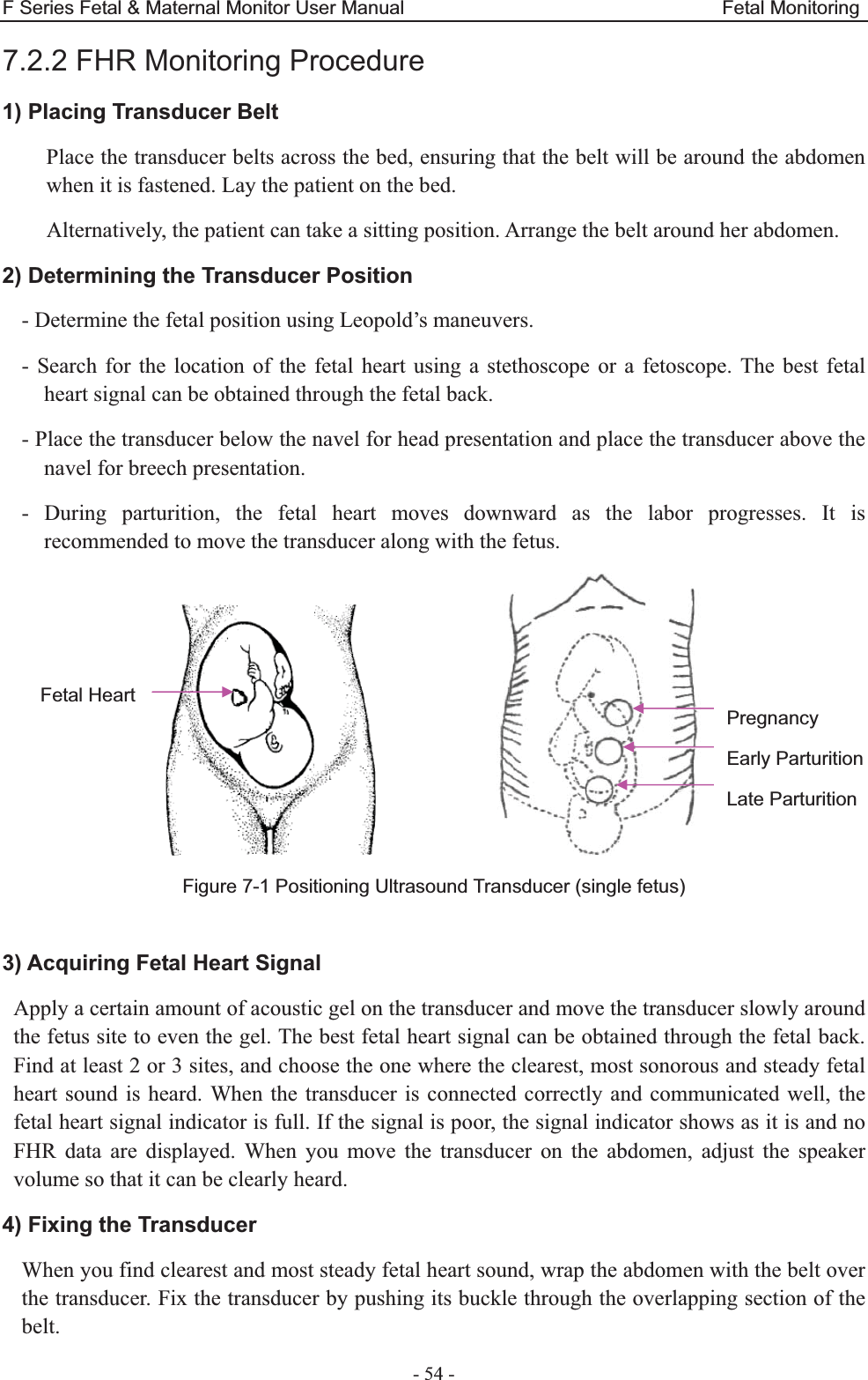 F Series Fetal &amp; Maternal Monitor User Manual                                 Fetal Monitoring - 54 - 7.2.2 FHR Monitoring Procedure 1) Placing Transducer Belt Place the transducer belts across the bed, ensuring that the belt will be around the abdomen when it is fastened. Lay the patient on the bed. Alternatively, the patient can take a sitting position. Arrange the belt around her abdomen. 2) Determining the Transducer Position - Determine the fetal position using Leopold’s maneuvers. - Search for the location of the fetal heart using a stethoscope or a fetoscope. The best fetal heart signal can be obtained through the fetal back. - Place the transducer below the navel for head presentation and place the transducer above the navel for breech presentation. - During parturition, the fetal heart moves downward as the labor progresses. It is recommended to move the transducer along with the fetus.              Figure 7-1 Positioning Ultrasound Transducer (single fetus)  3) Acquiring Fetal Heart Signal Apply a certain amount of acoustic gel on the transducer and move the transducer slowly around the fetus site to even the gel. The best fetal heart signal can be obtained through the fetal back. Find at least 2 or 3 sites, and choose the one where the clearest, most sonorous and steady fetal heart sound is heard. When the transducer is connected correctly and communicated well, the fetal heart signal indicator is full. If the signal is poor, the signal indicator shows as it is and no FHR data are displayed. When you move the transducer on the abdomen, adjust the speaker volume so that it can be clearly heard. 4) Fixing the Transducer When you find clearest and most steady fetal heart sound, wrap the abdomen with the belt over the transducer. Fix the transducer by pushing its buckle through the overlapping section of the belt. Fetal Heart Pregnancy Early Parturition Late Parturition 