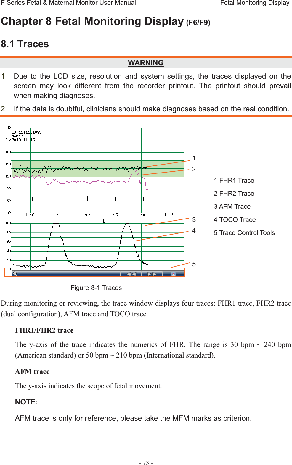 F Series Fetal &amp; Maternal Monitor User Manual                          Fetal Monitoring Display - 73 - Chapter 8 Fetal Monitoring Display (F6/F9)8.1 Traces WARNING1  Due to the LCD size, resolution and system settings, the traces displayed on the screen may look different from the recorder printout. The printout should prevail when making diagnoses. 2  If the data is doubtful, clinicians should make diagnoses based on the real condition.    Figure 8-1 Traces During monitoring or reviewing, the trace window displays four traces: FHR1 trace, FHR2 trace (dual configuration), AFM trace and TOCO trace. FHR1/FHR2 trace The y-axis of the trace indicates the numerics of FHR. The range is 30 bpm ~ 240 bpm (American standard) or 50 bpm ~ 210 bpm (International standard). AFM trace The y-axis indicates the scope of fetal movement. NOTE:AFM trace is only for reference, please take the MFM marks as criterion. 1 FHR1 Trace 2 FHR2 Trace 3 AFM Trace 4 TOCO Trace 5 Trace Control Tools 1 2    3 4   5 