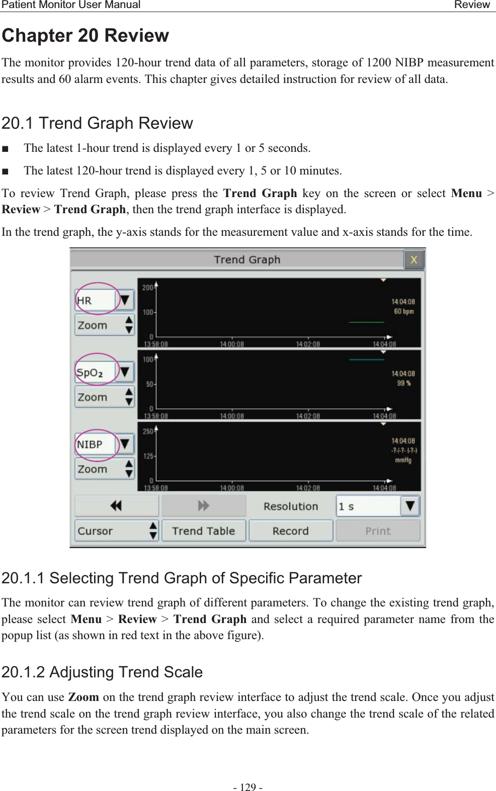 Patient Monitor User Manual                                                         Review  - 129 - Chapter 20 ReviewThe monitor provides 120-hour trend data of all parameters, storage of 1200 NIBP measurement results and 60 alarm events. This chapter gives detailed instruction for review of all data. 20.1 Trend Graph Review  The latest 1-hour trend is displayed every 1 or 5 seconds.  The latest 120-hour trend is displayed every 1, 5 or 10 minutes. To review Trend Graph, please press the Trend Graph key on the screen or select Menu &gt; Review &gt; Trend Graph, then the trend graph interface is displayed.   In the trend graph, the y-axis stands for the measurement value and x-axis stands for the time.    20.1.1 Selecting Trend Graph of Specific ParameterThe monitor can review trend graph of different parameters. To change the existing trend graph, please select Menu &gt; Review &gt; Trend Graph and select a required parameter name from the popup list (as shown in red text in the above figure). 20.1.2 Adjusting Trend Scale You can use Zoom on the trend graph review interface to adjust the trend scale. Once you adjust the trend scale on the trend graph review interface, you also change the trend scale of the related parameters for the screen trend displayed on the main screen. 
