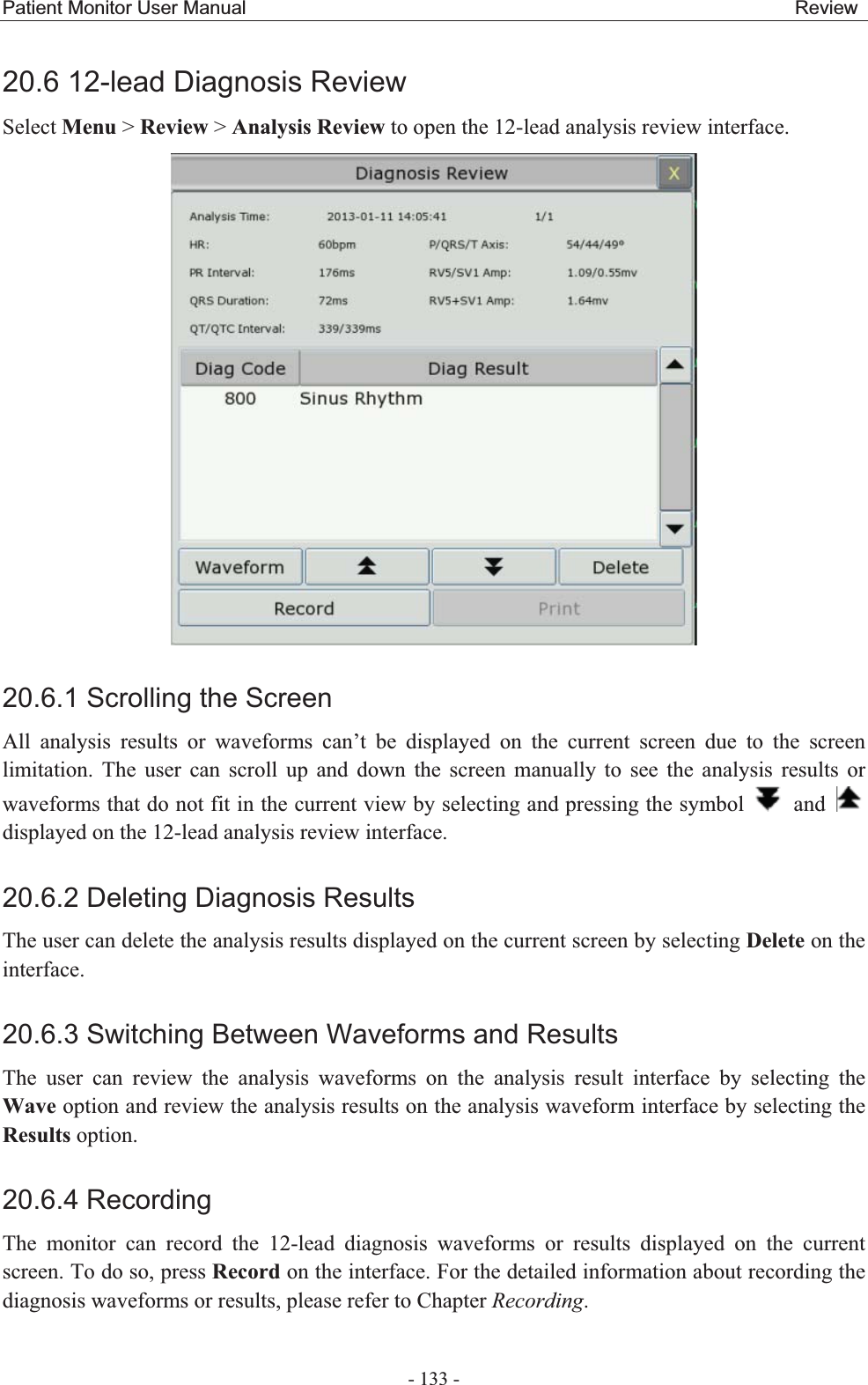 Patient Monitor User Manual                                                         Review  - 133 - 20.6 12-lead Diagnosis Review Select Menu &gt; Review &gt; Analysis Review to open the 12-lead analysis review interface.  20.6.1 Scrolling the Screen All analysis results or waveforms can’t be displayed on the current screen due to the screen limitation. The user can scroll up and down the screen manually to see the analysis results or waveforms that do not fit in the current view by selecting and pressing the symbol   and   displayed on the 12-lead analysis review interface.   20.6.2 Deleting Diagnosis Results The user can delete the analysis results displayed on the current screen by selecting Delete on the interface.  20.6.3 Switching Between Waveforms and ResultsThe user can review the analysis waveforms on the analysis result interface by selecting the Wave option and review the analysis results on the analysis waveform interface by selecting the Results option. 20.6.4 RecordingThe monitor can record the 12-lead diagnosis waveforms or results displayed on the current screen. To do so, press Record on the interface. For the detailed information about recording the diagnosis waveforms or results, please refer to Chapter Recording. 
