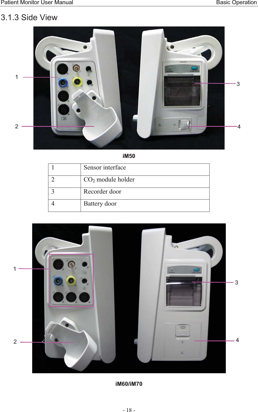 Patient Monitor User Manual                                                  Basic Operation  - 18 - 3.1.3 Side View  iM501 Sensor interface 2 CO2 module holder 3 Recorder door 4 Battery door   iM60/iM7012341234