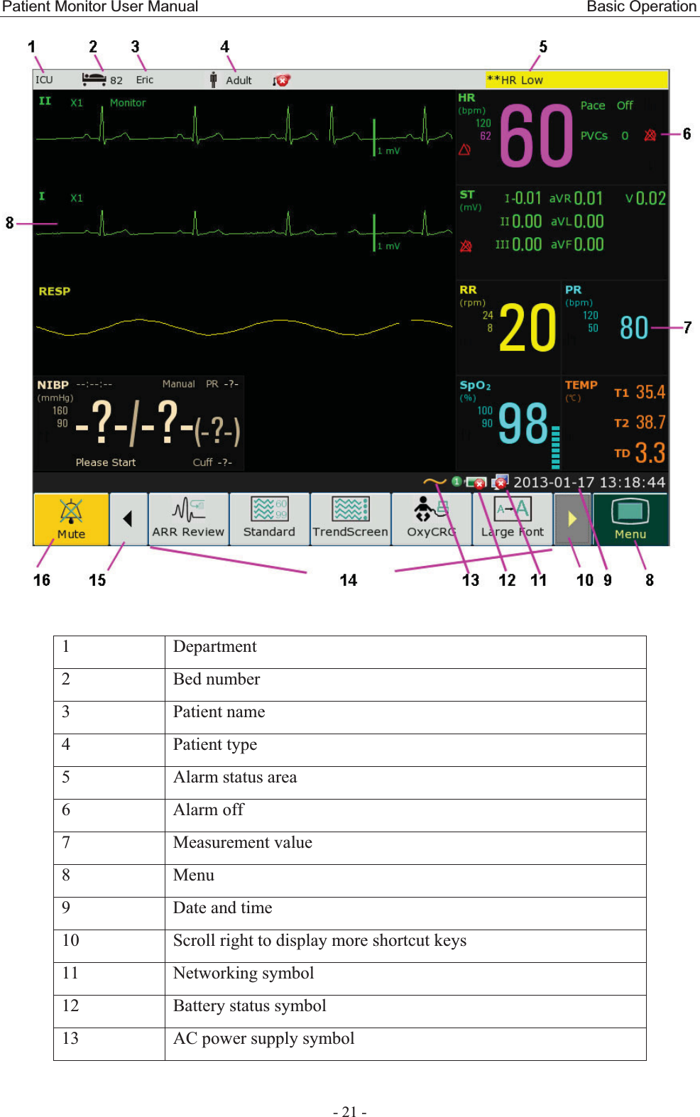 Patient Monitor User Manual                                                  Basic Operation  - 21 -   1 Department 2 Bed number 3 Patient name 4 Patient type 5  Alarm status area 6 Alarm off 7 Measurement value 8 Menu 9  Date and time 10  Scroll right to display more shortcut keys 11 Networking symbol 12 Battery status symbol 13  AC power supply symbol   
