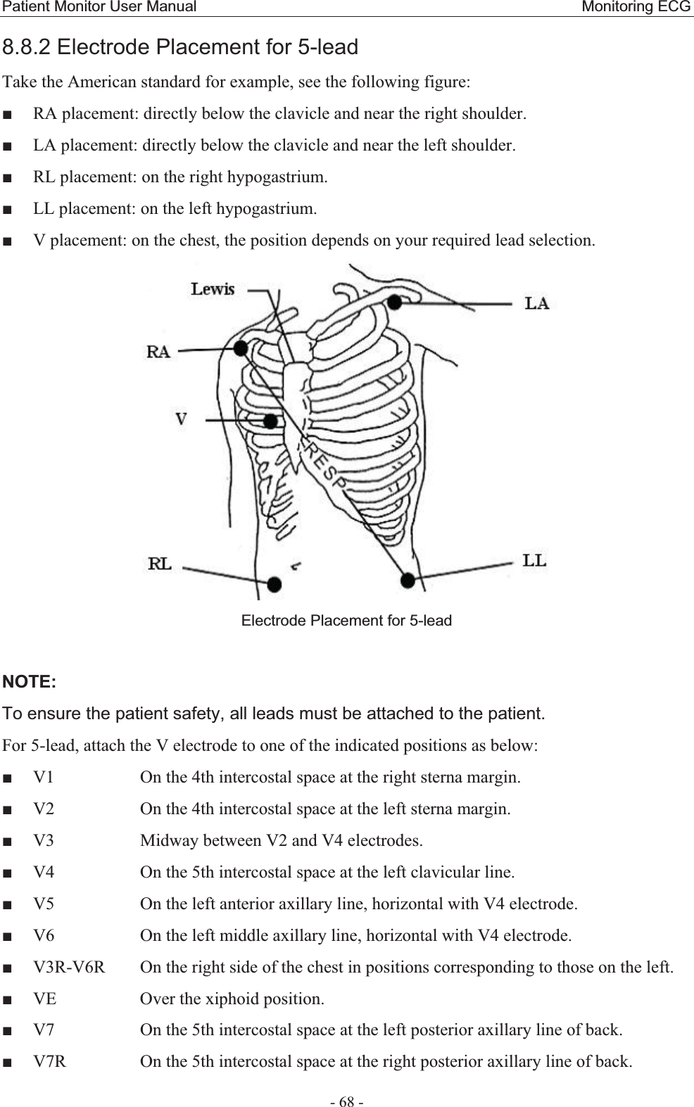 Patient Monitor User Manual                                                  Monitoring ECG  - 68 - 8.8.2 Electrode Placement for 5-lead Take the American standard for example, see the following figure:  RA placement: directly below the clavicle and near the right shoulder.  LA placement: directly below the clavicle and near the left shoulder.  RL placement: on the right hypogastrium.  LL placement: on the left hypogastrium.  V placement: on the chest, the position depends on your required lead selection.  Electrode Placement for 5-lead   NOTE:To ensure the patient safety, all leads must be attached to the patient.   For 5-lead, attach the V electrode to one of the indicated positions as below:    V1      On the 4th intercostal space at the right sterna margin.  V2      On the 4th intercostal space at the left sterna margin.  V3      Midway between V2 and V4 electrodes.  V4      On the 5th intercostal space at the left clavicular line.  V5      On the left anterior axillary line, horizontal with V4 electrode.  V6      On the left middle axillary line, horizontal with V4 electrode.  V3R-V6R   On the right side of the chest in positions corresponding to those on the left.  VE      Over the xiphoid position.  V7      On the 5th intercostal space at the left posterior axillary line of back.  V7R     On the 5th intercostal space at the right posterior axillary line of back. 